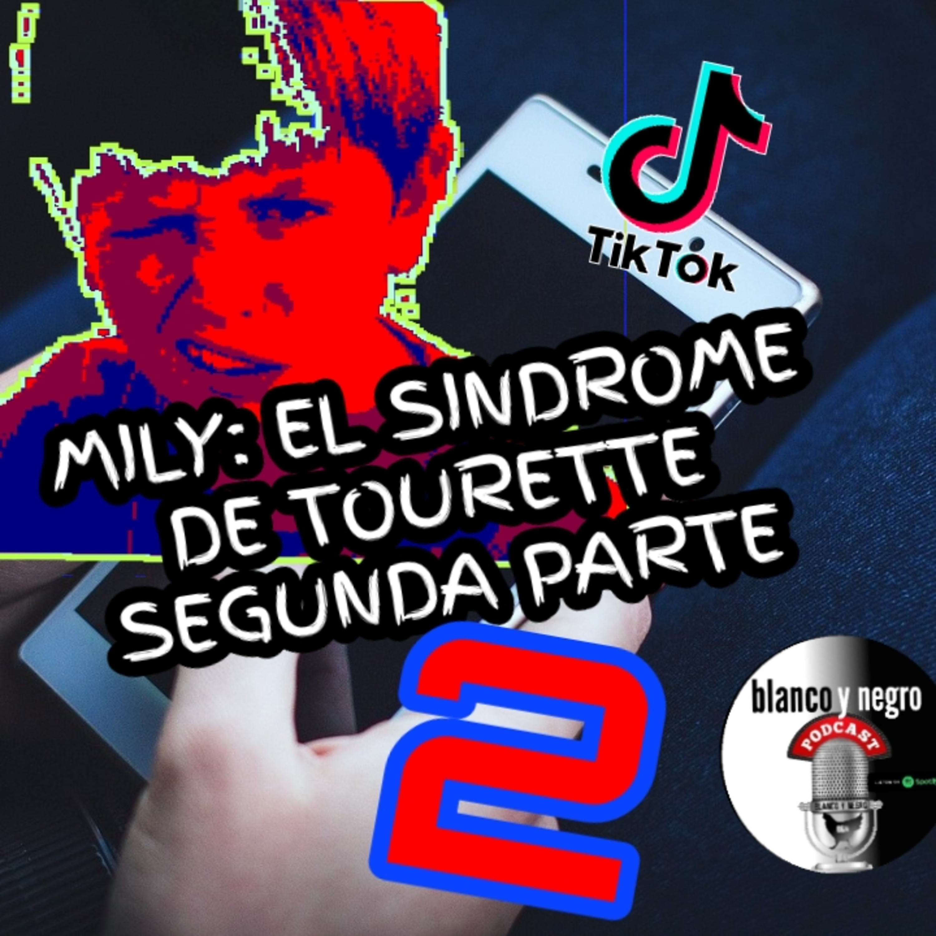 EL SÍNDROME DE TOURETTE PARTE.2, EN LA MÚSICA "QUIERO CLUB" episode artwork