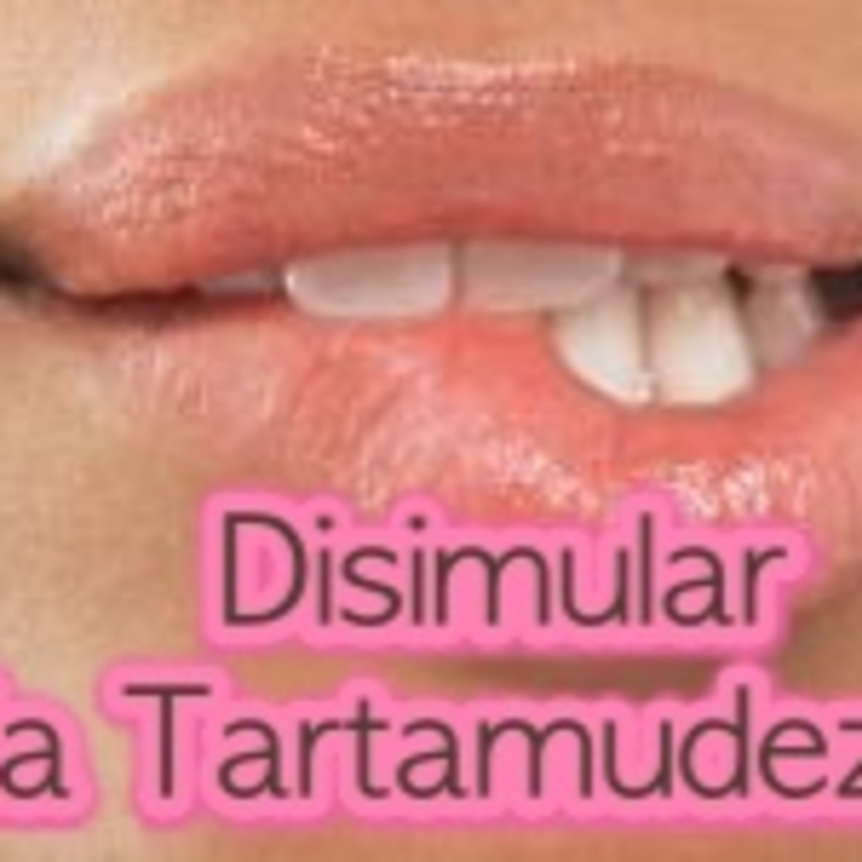 Tartamudez y Yo