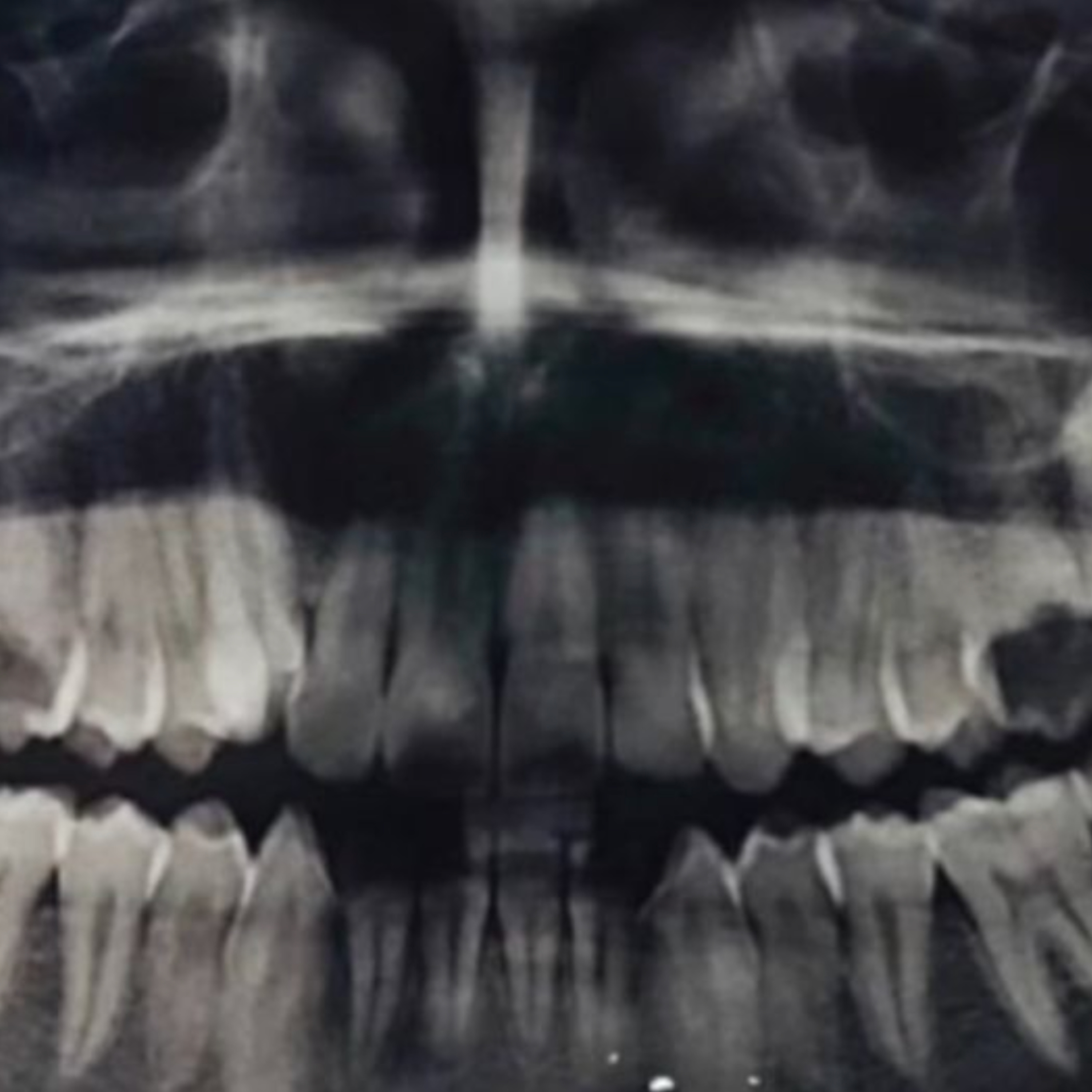 ¿Sabes lo que dicen los dientes POR ti? Con Dra. Carina Titton episode artwork