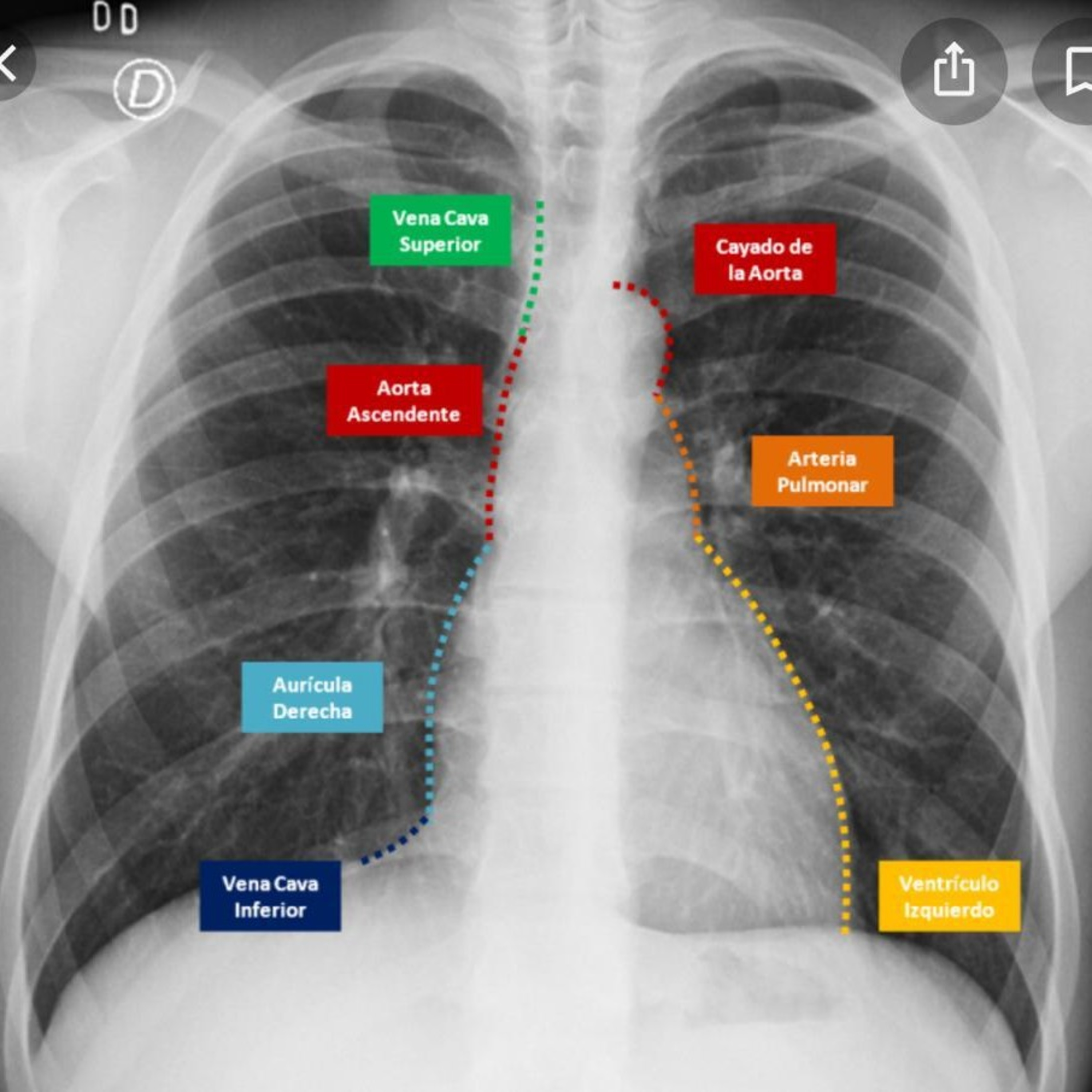 Medicina Interna de Agudos