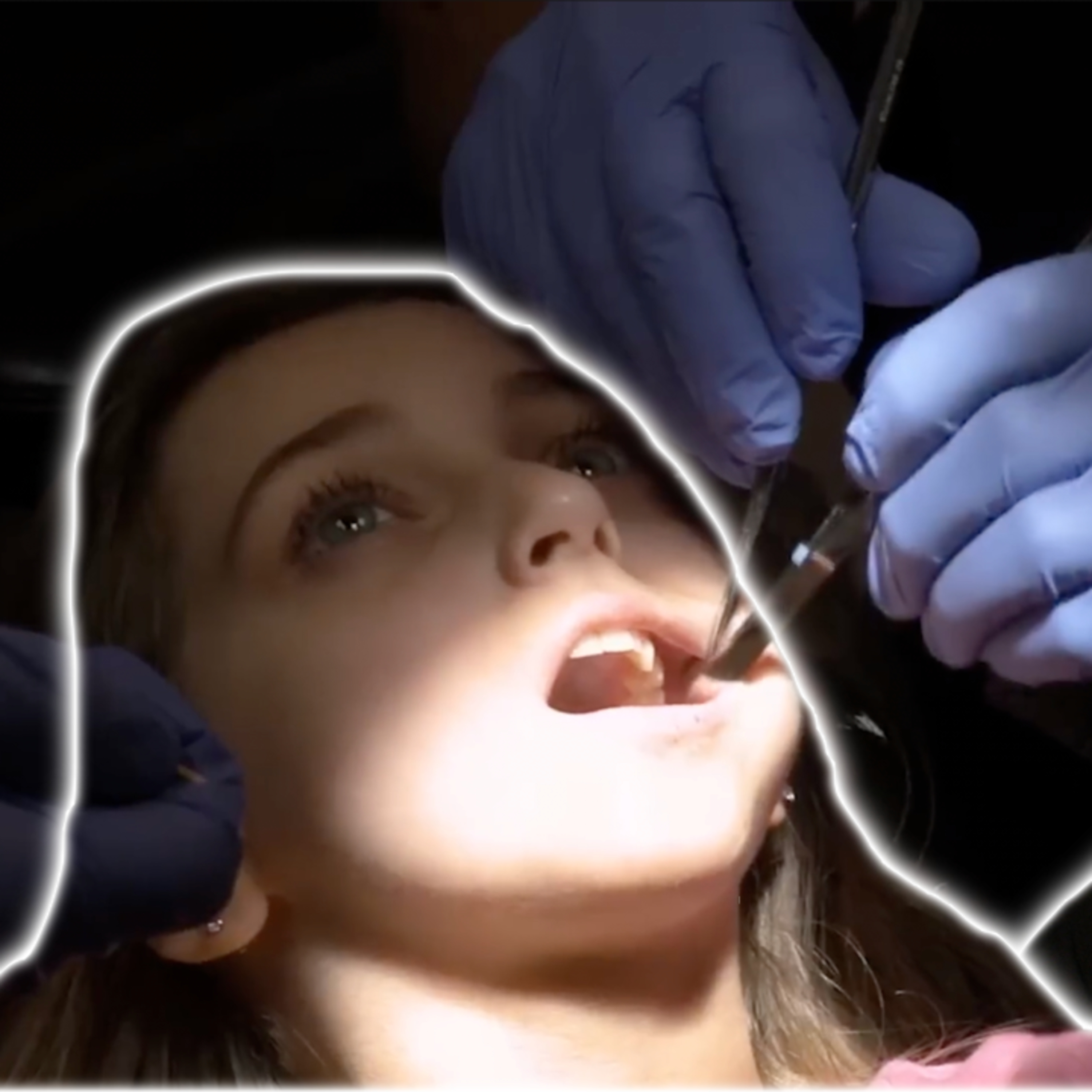 Shauna Rae Still Has Her Baby Teeth! I Am Shauna Rae