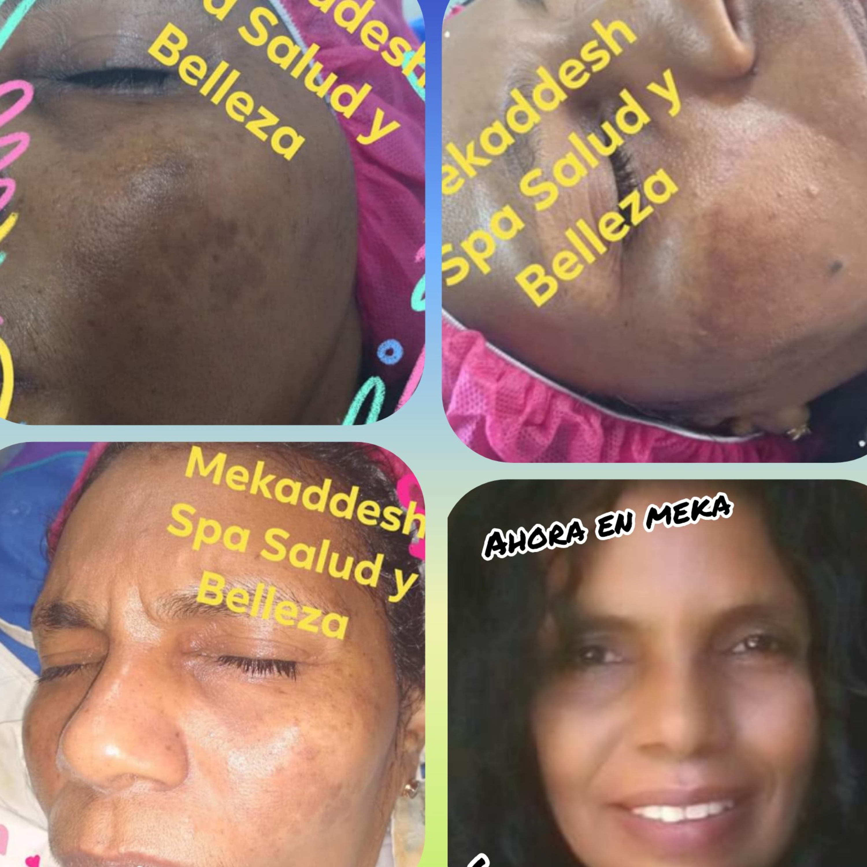 Anomalías de la.piel del rostro según su tipo.