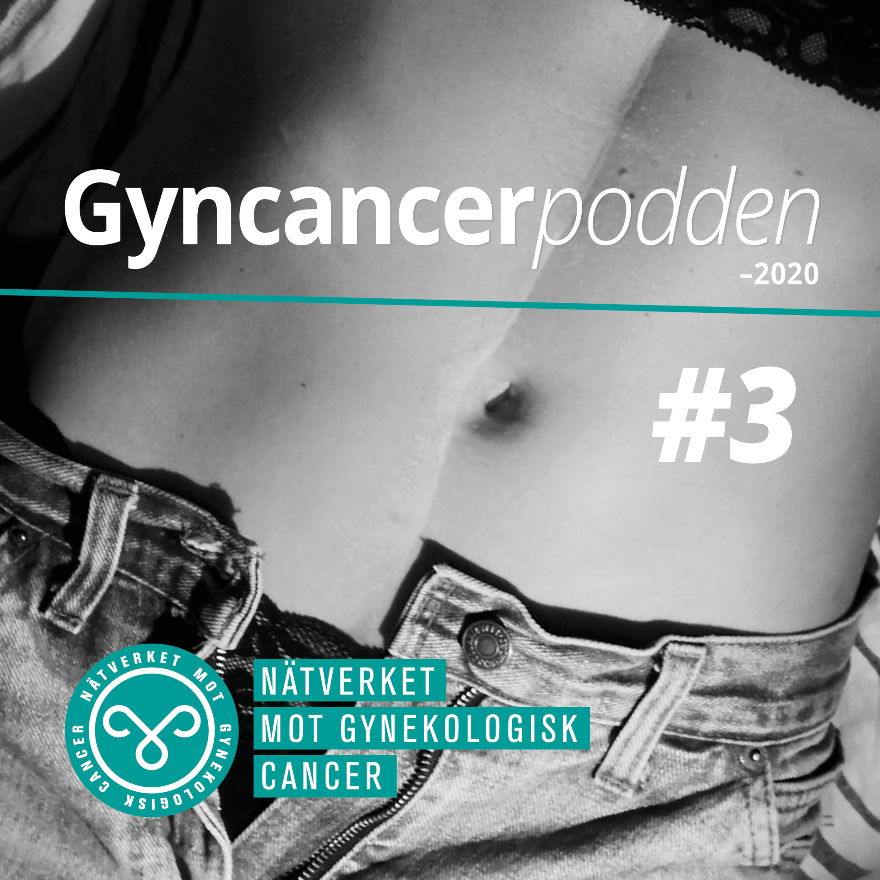 Gyncancerpodden