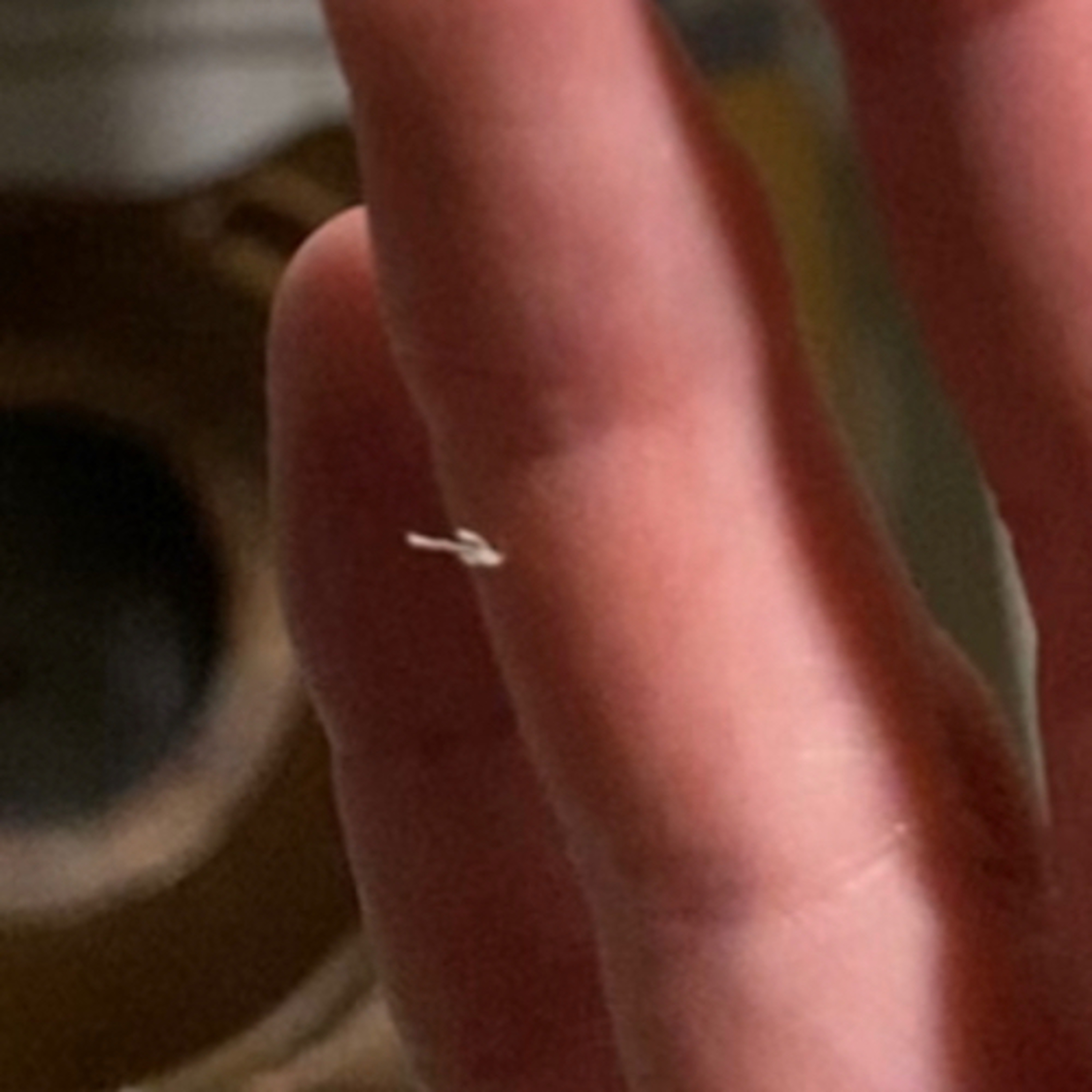 The Real History of Morgellons (Part One)