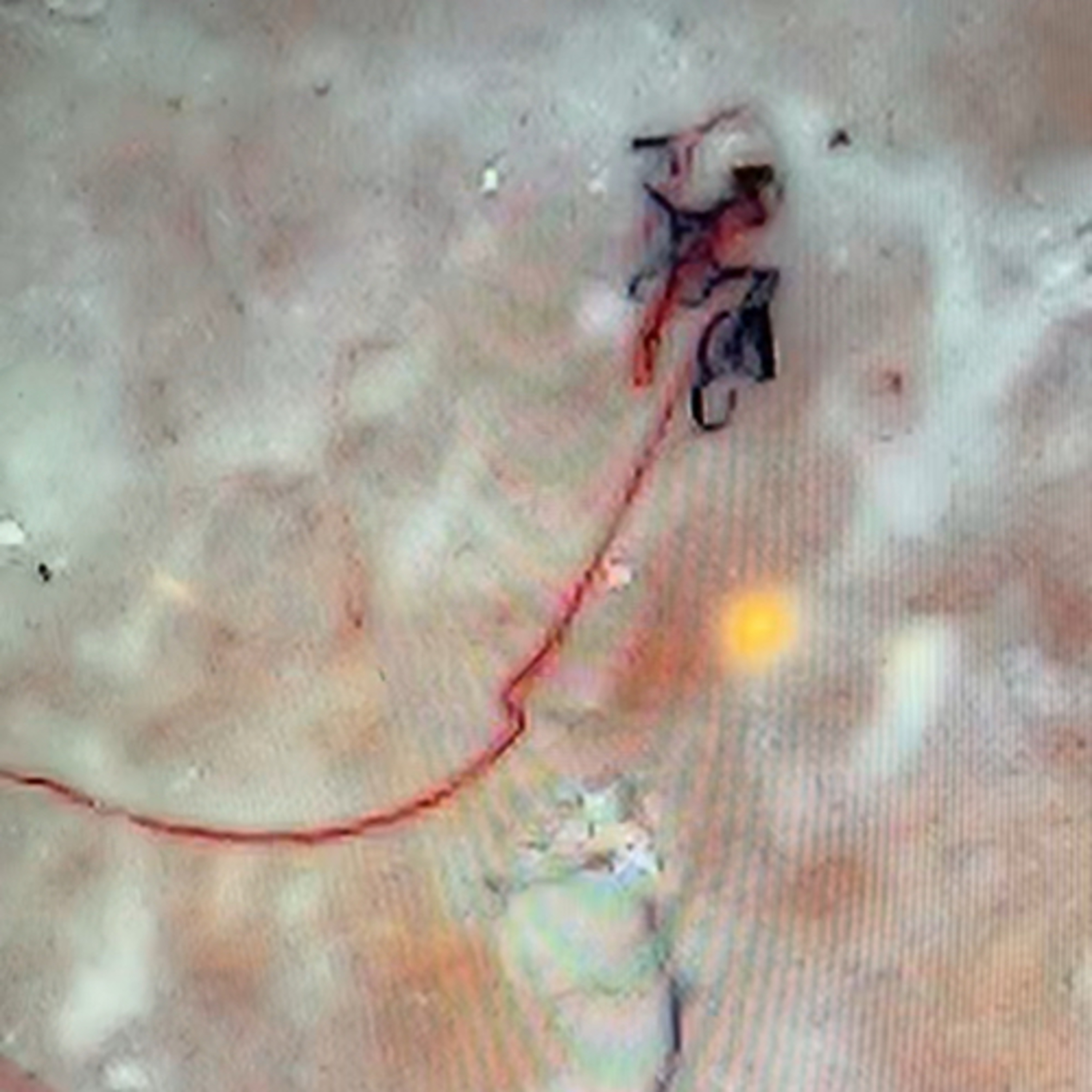 Targeted Individual Dr. Susan Kolb