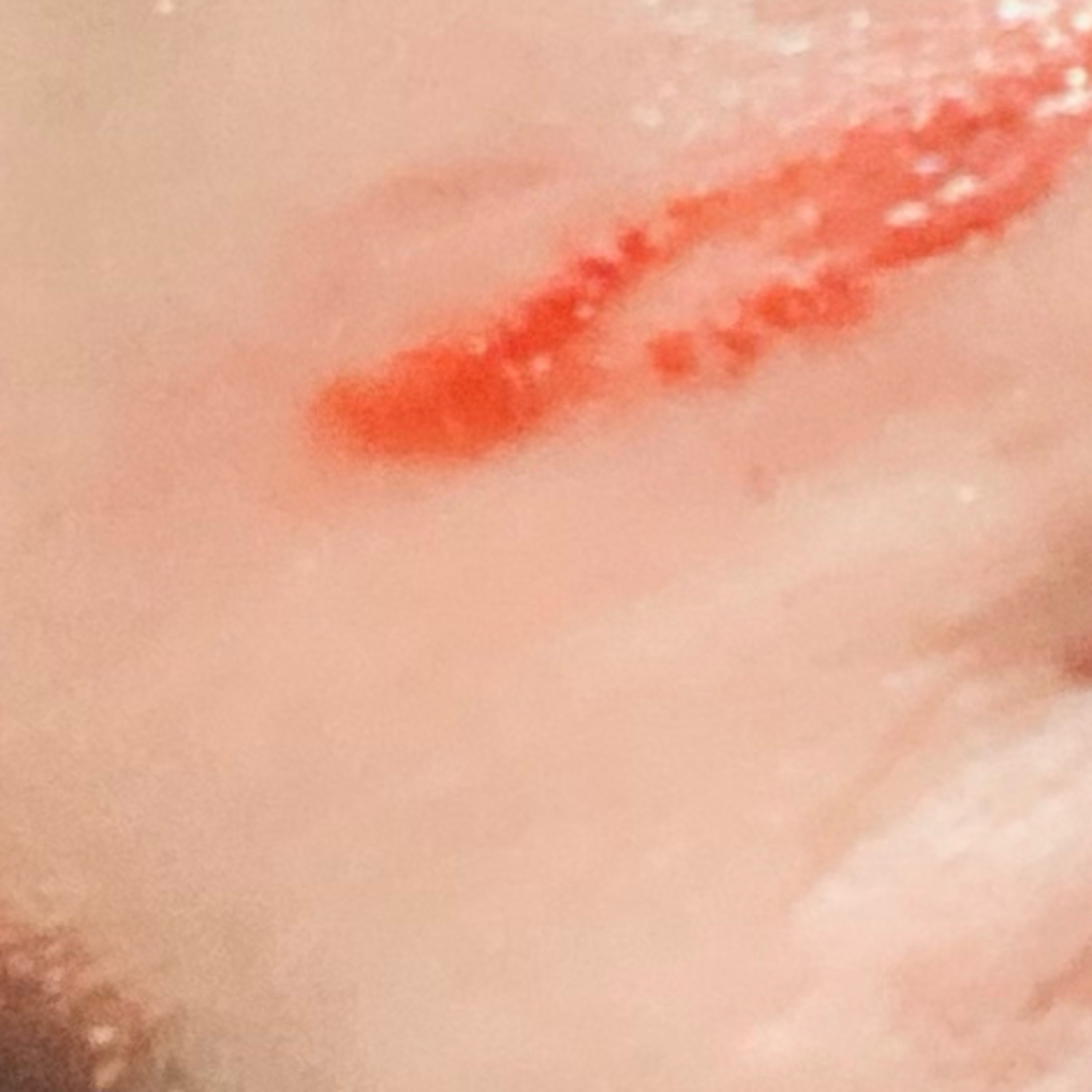 String Theory of The String Disease Morgellons