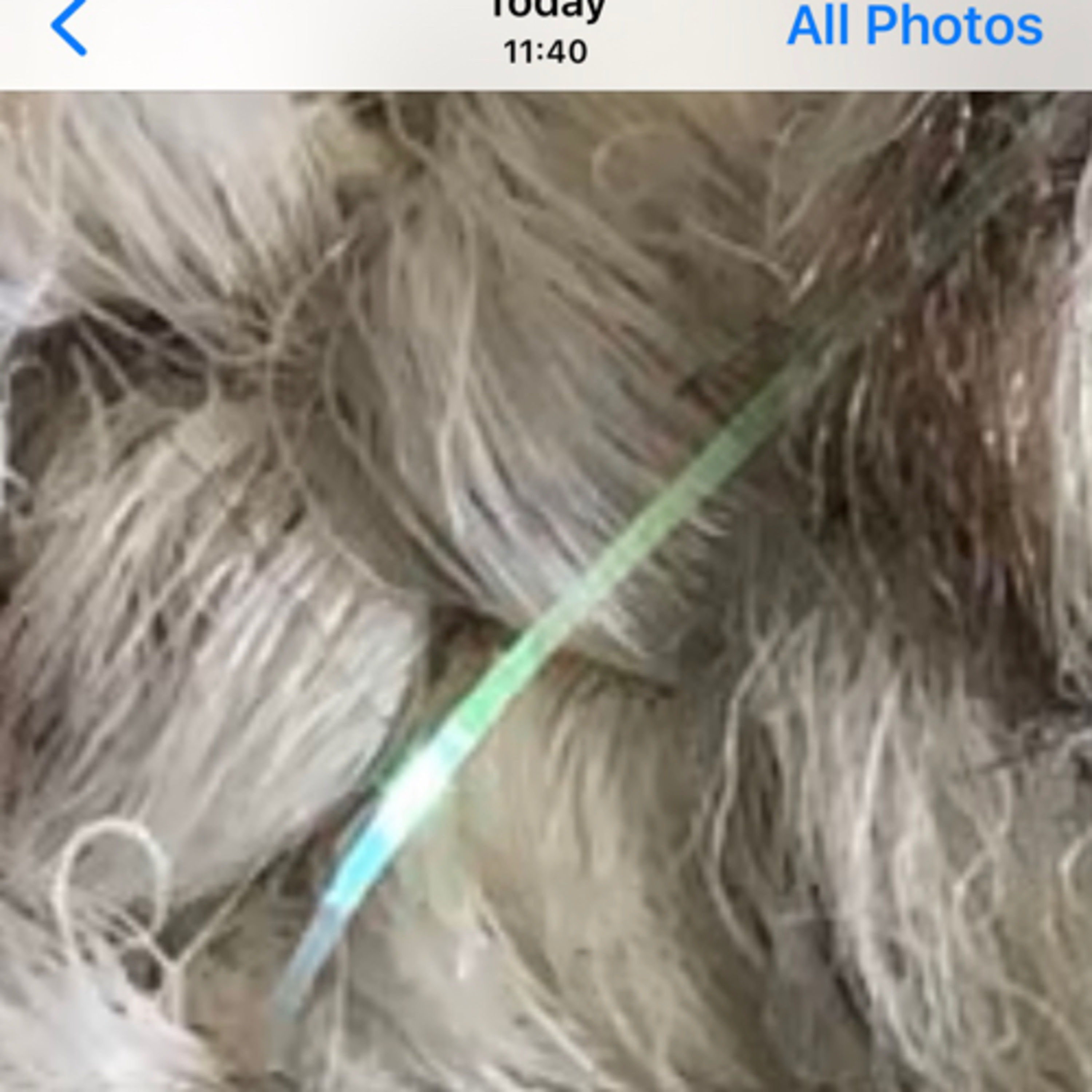 Morgellons: Mass Psychogenic Illness