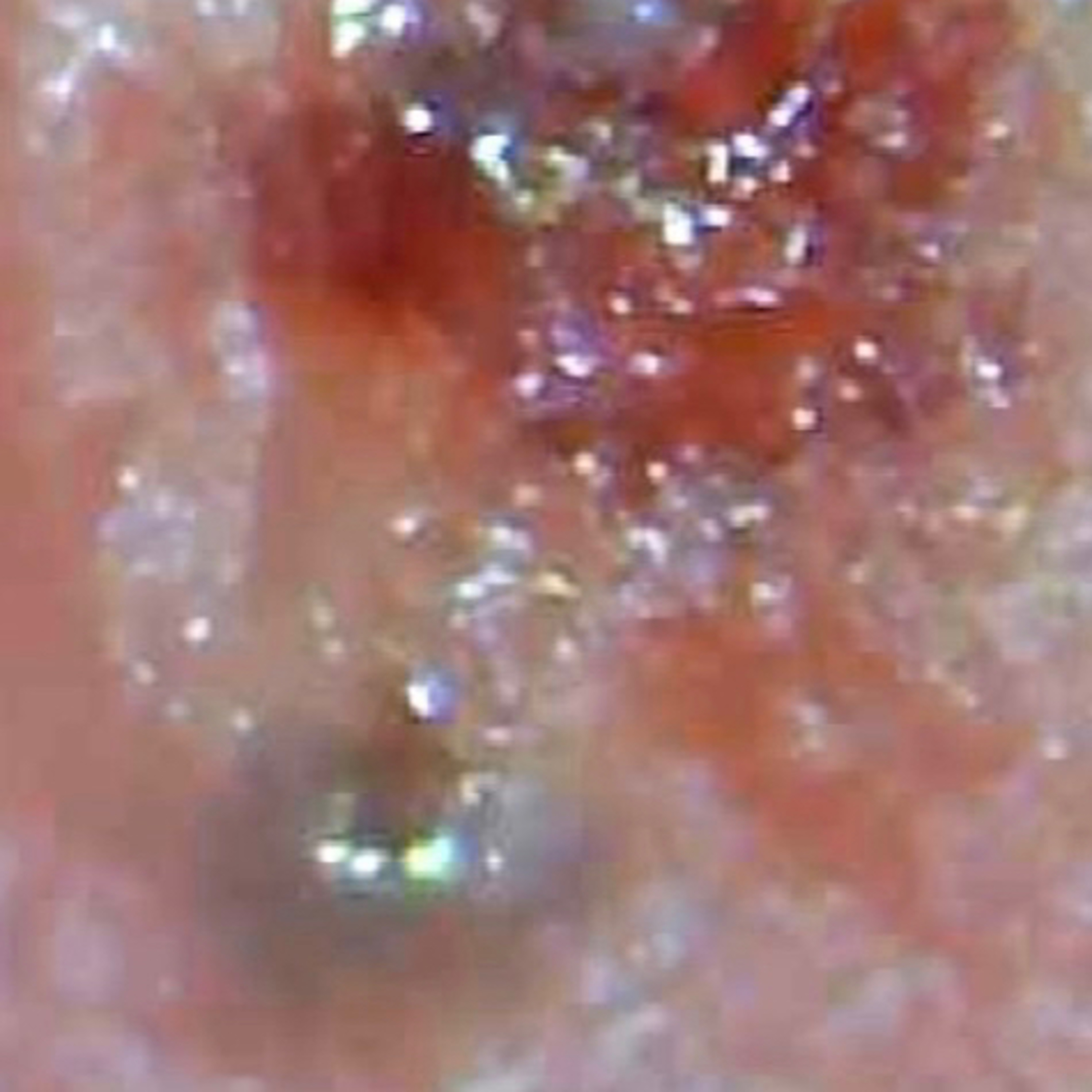 Morgellons Whistleblowers?