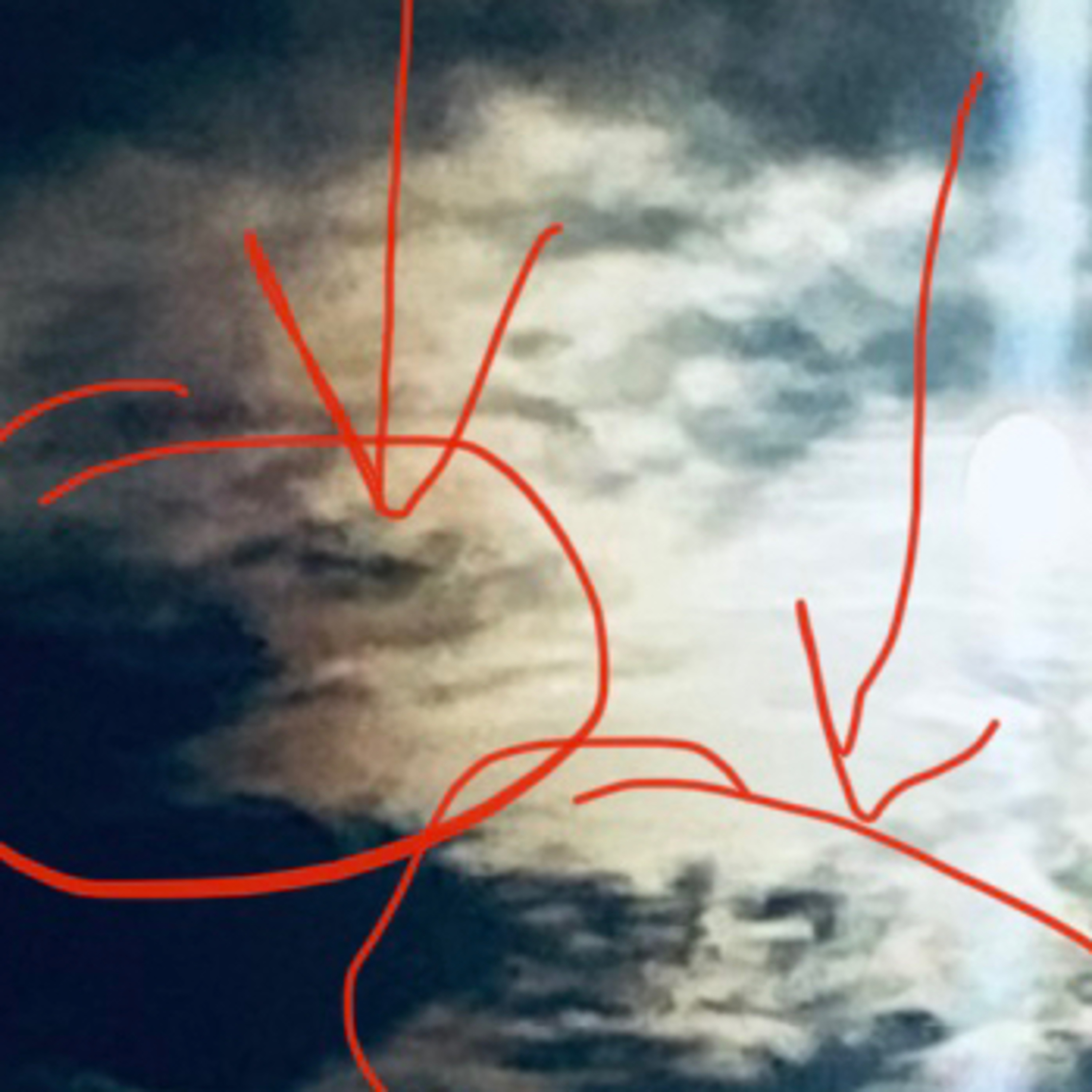 How do you say Morgellons?