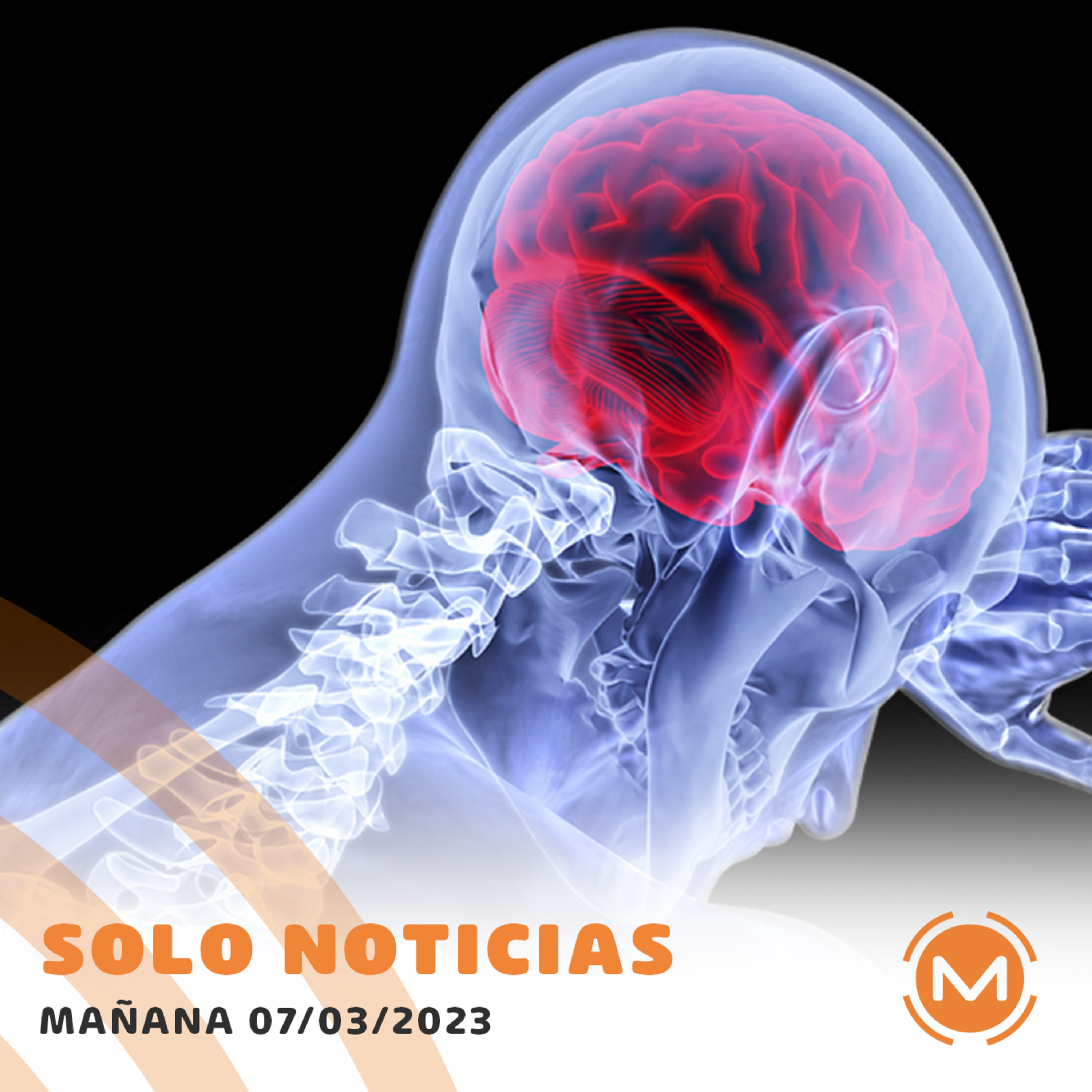 Portada de Monumental AM 1080