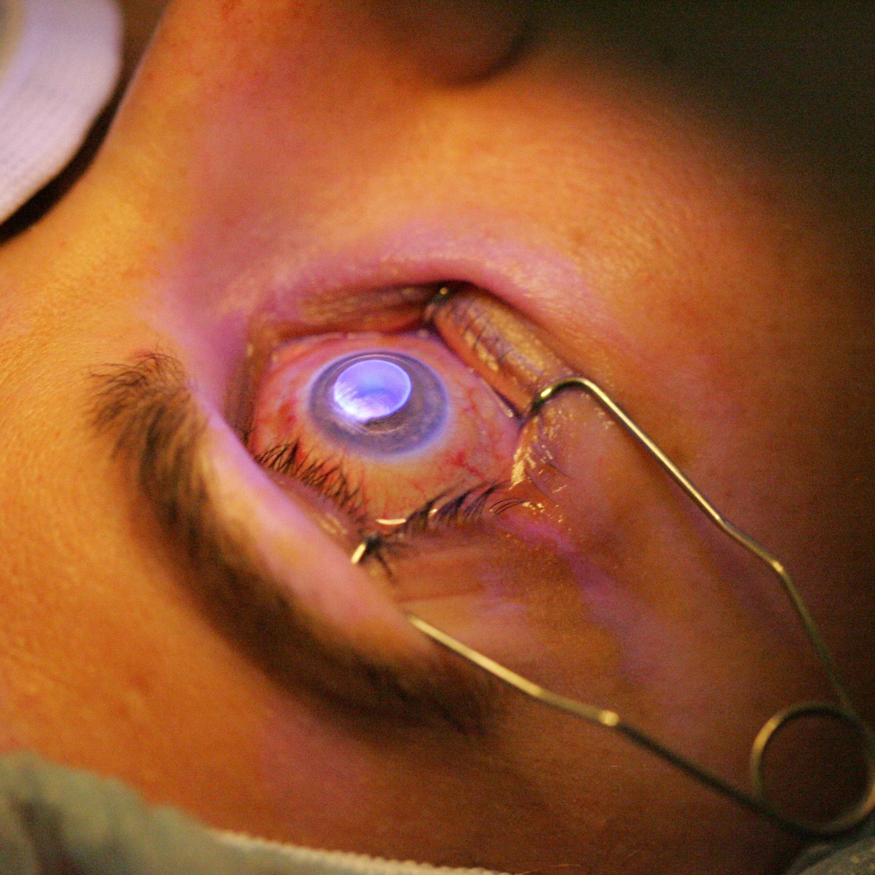 LASIK Christmas (Ft. Dan the Man)