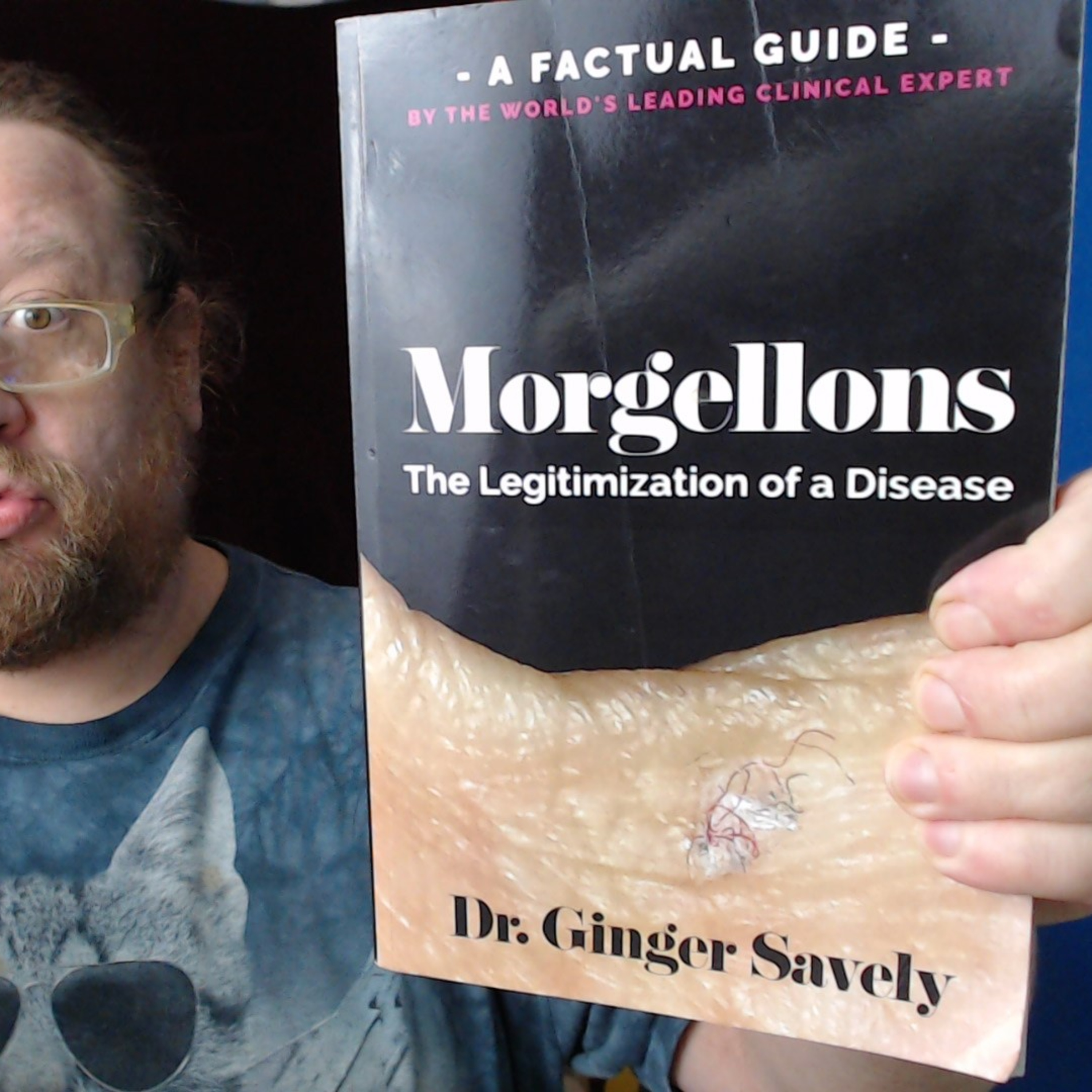Morgellons Discussion