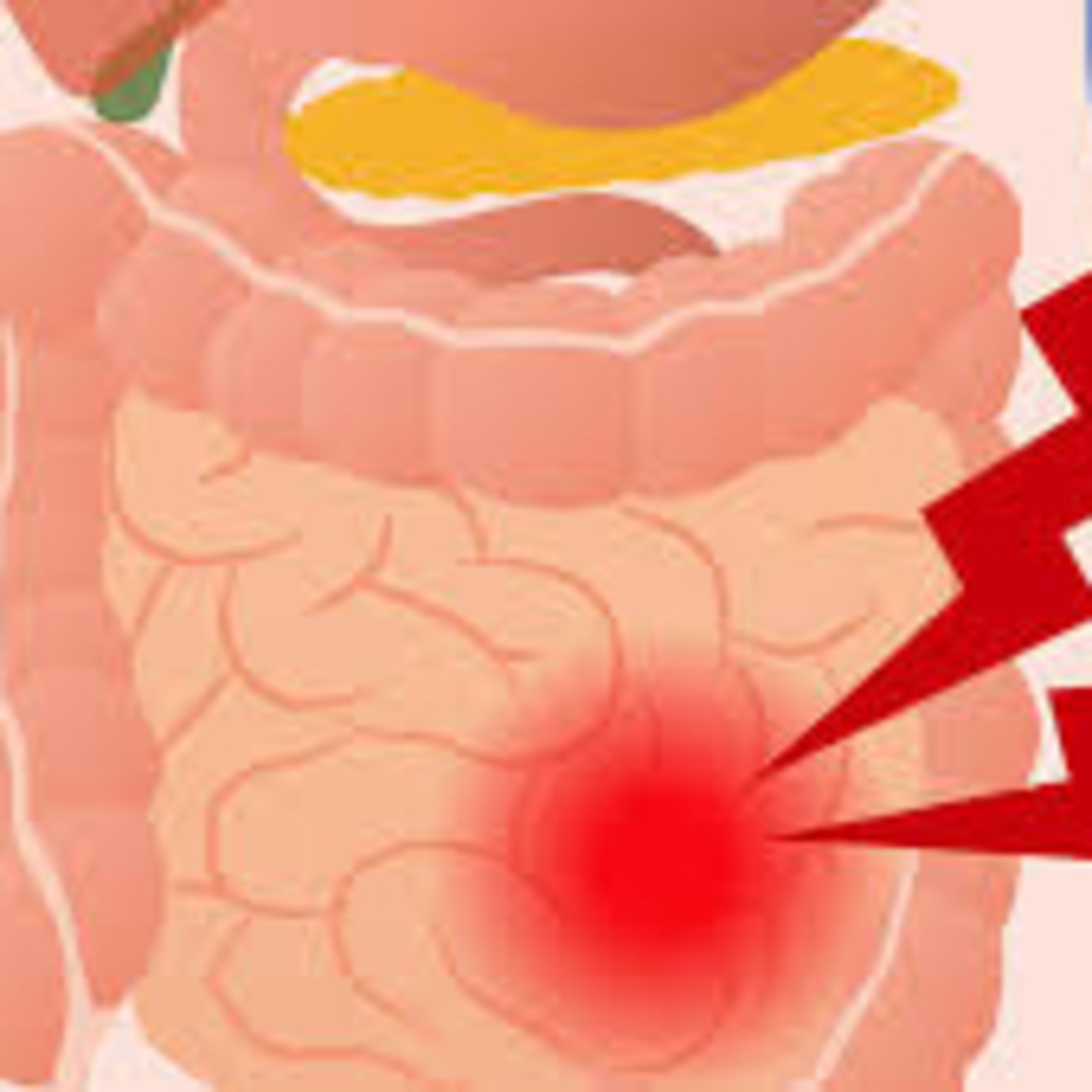 SÍNDROME DEL INTESTINO IRRITABLE😵‍💫👩🏼‍⚕️🌀 episode artwork