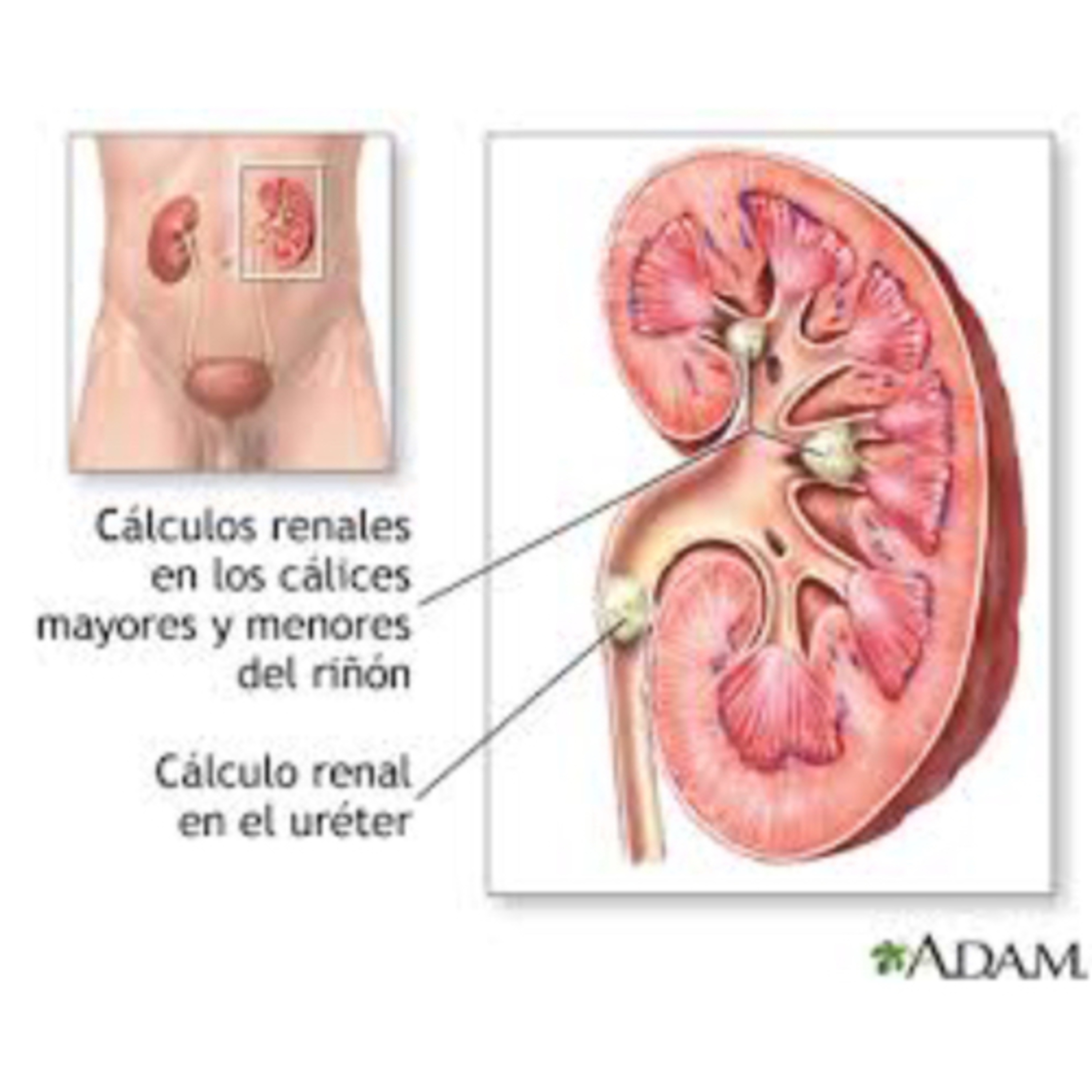 CÁLCULO RENAL: FORMACIÓN/Marta Delgado 1U/Podcast 1 Tercer Trimestre episode artwork