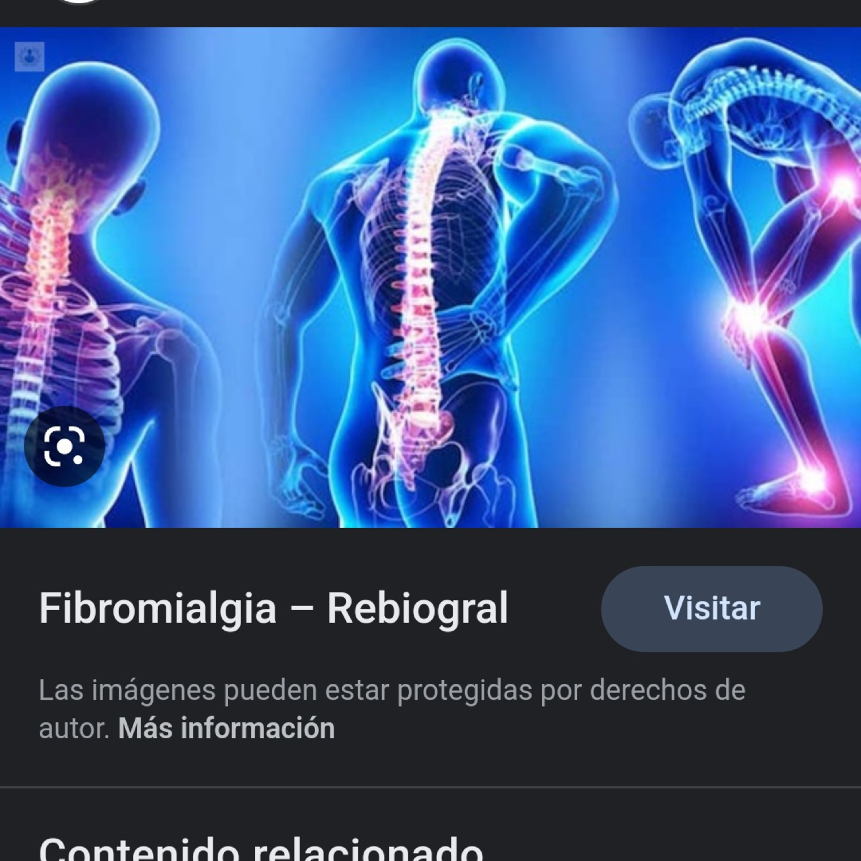 Fibromialgia/ Susana Muñoz Sánchez 