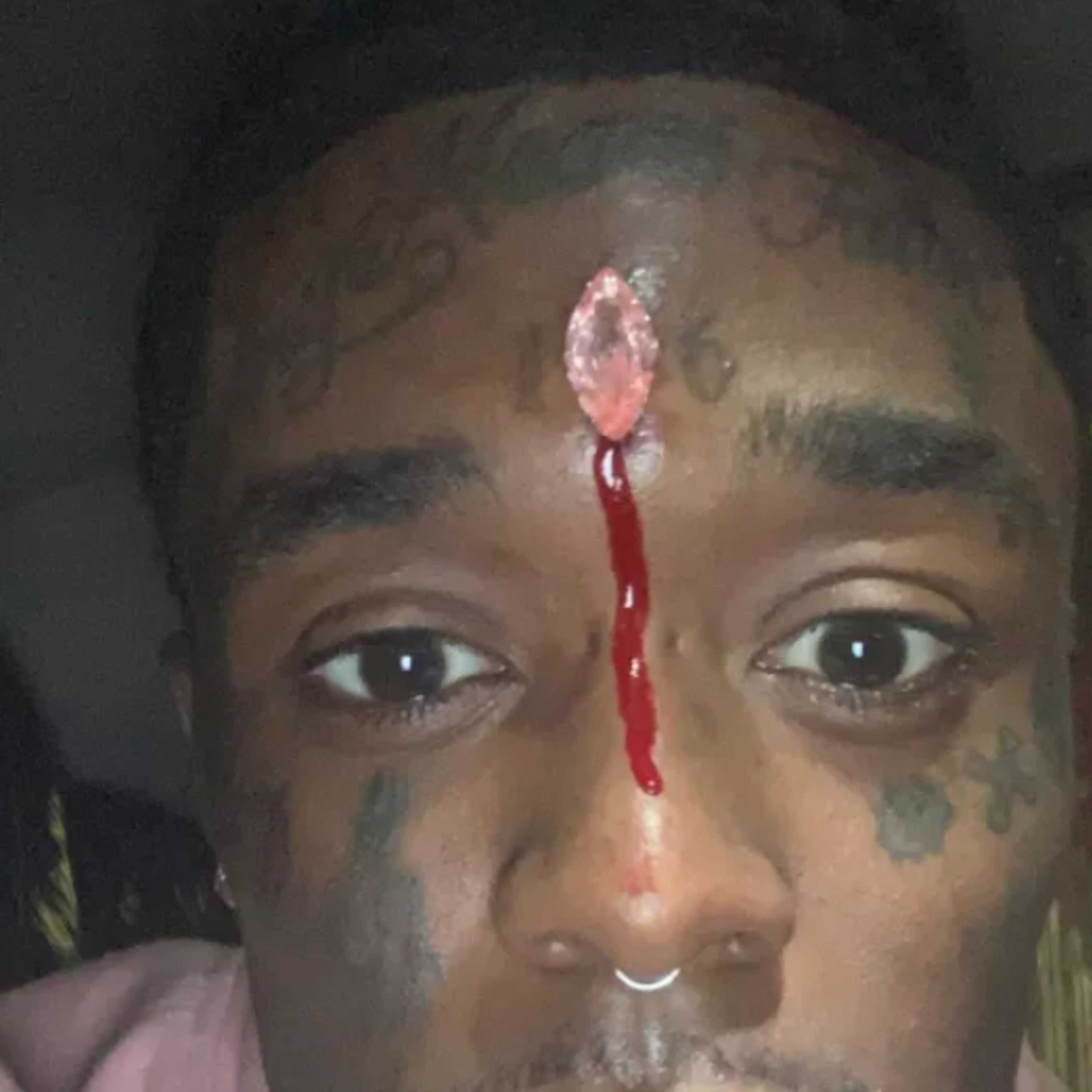 Vol 18: Lil Uzi Vert Doing Stupid S🤬‼️/Golden Globes Turning White Again