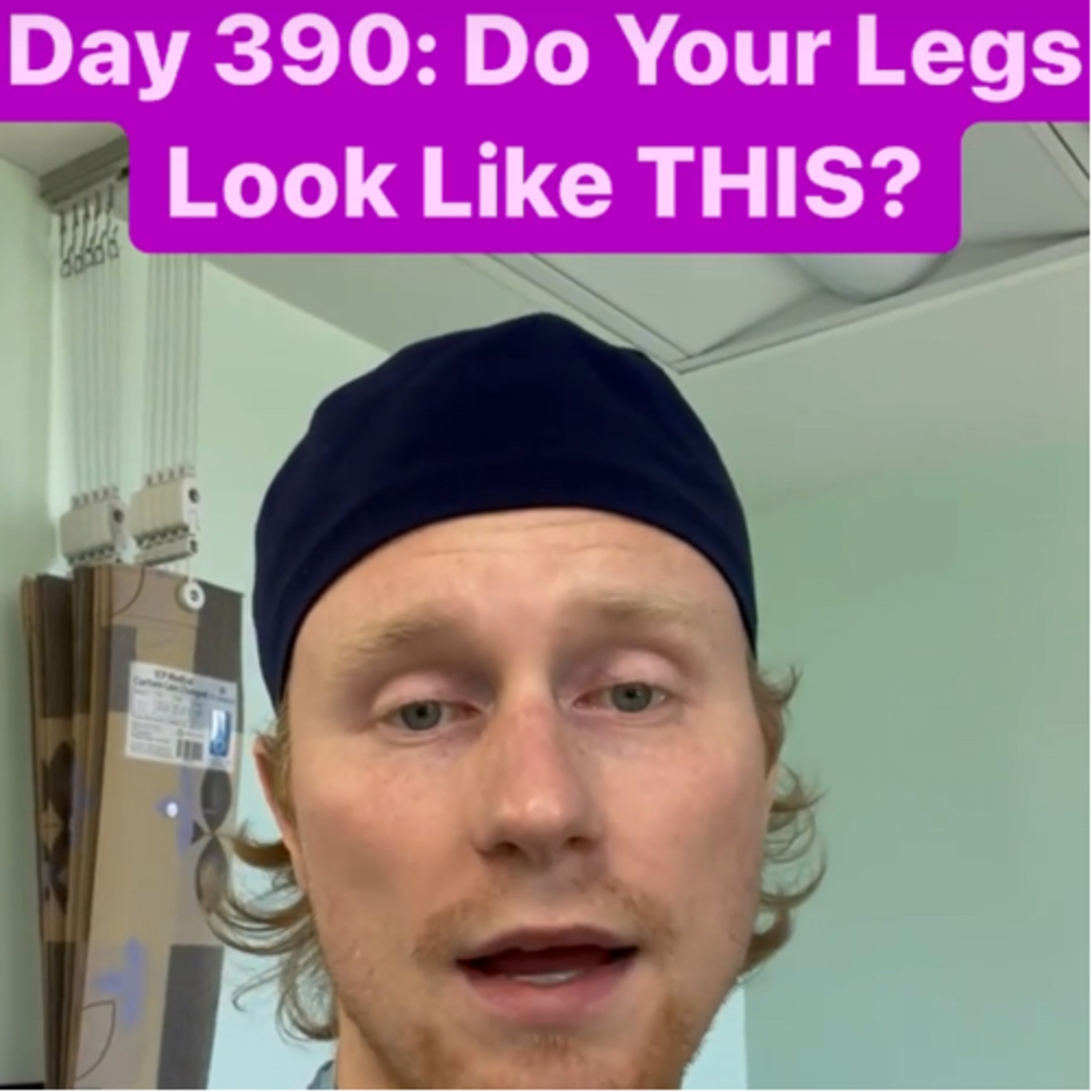 390: Do You Have Legs Like This?? 7.25.22 episode artwork