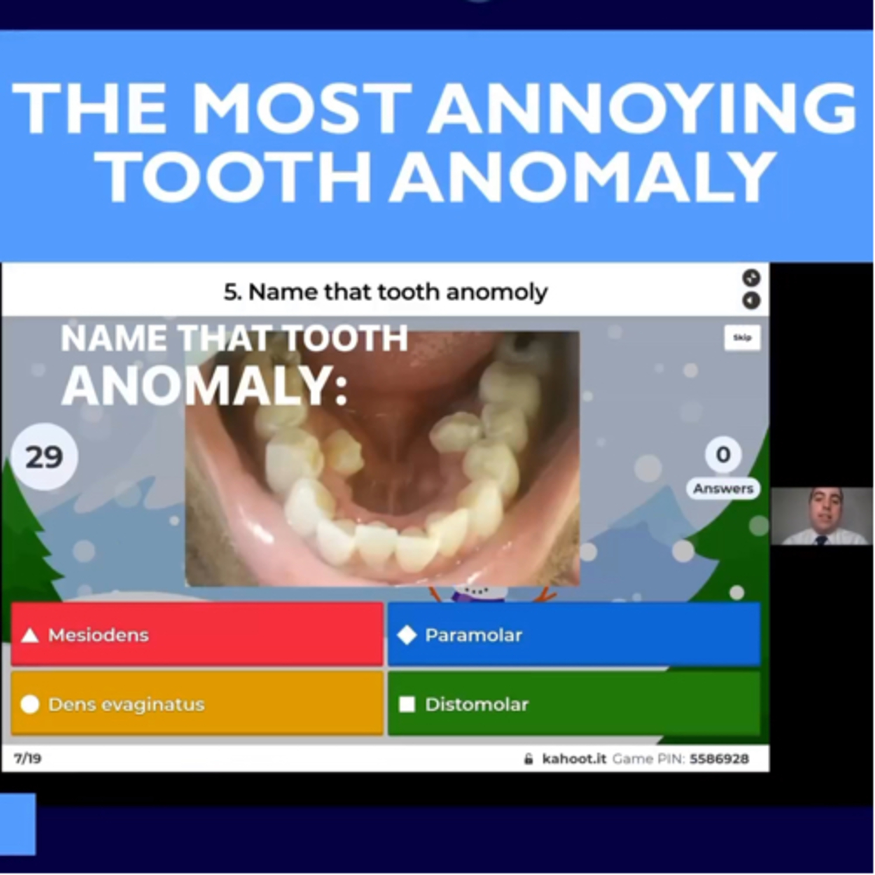 Do you know this Tooth Anomaly? with @stephenrothdds on insta, on @doseofdentalpodcast