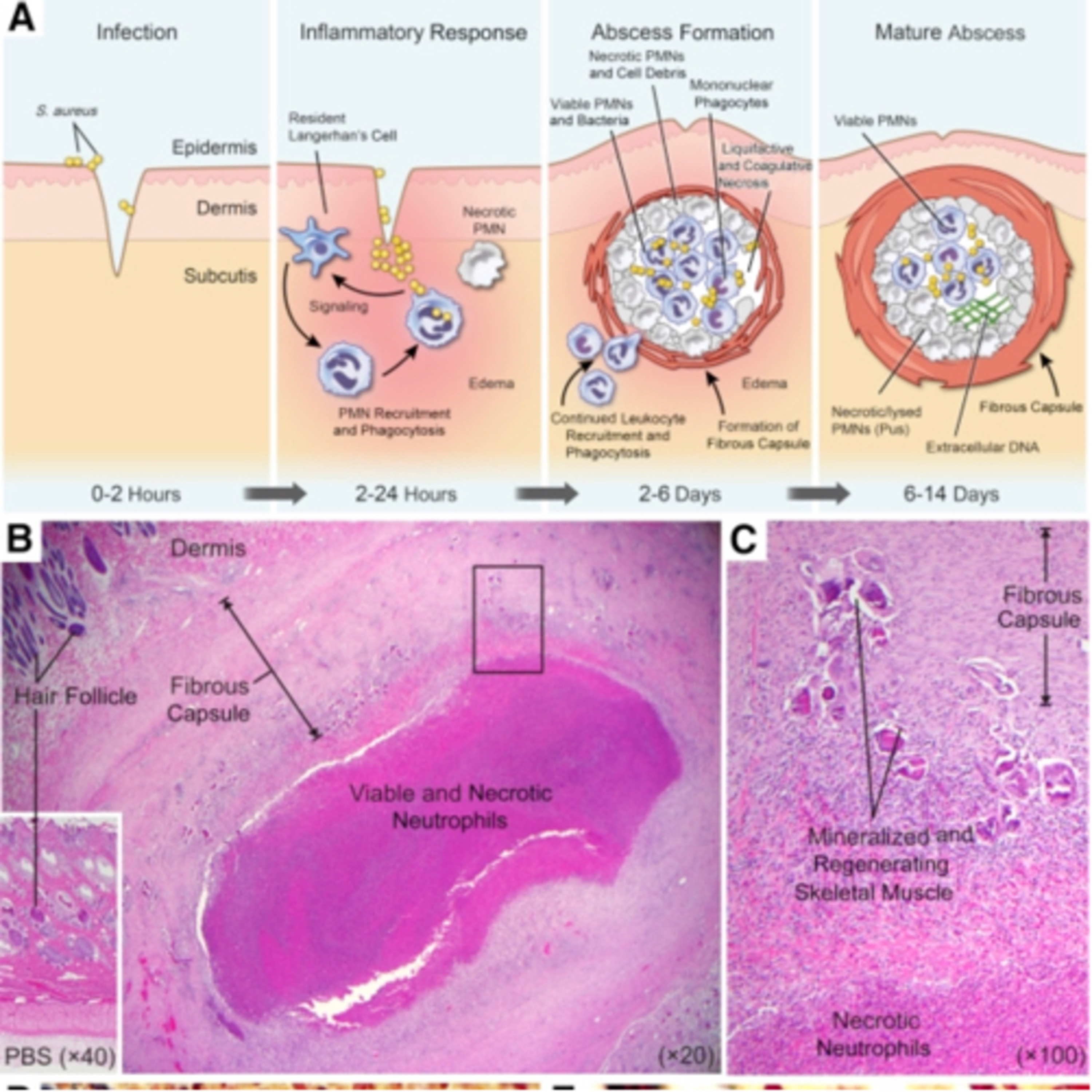 “What are the Stages of Odontogenic Abscess Formation?” + Updates (PODCAST EXCLUSIVE) 7.25.23 episode artwork