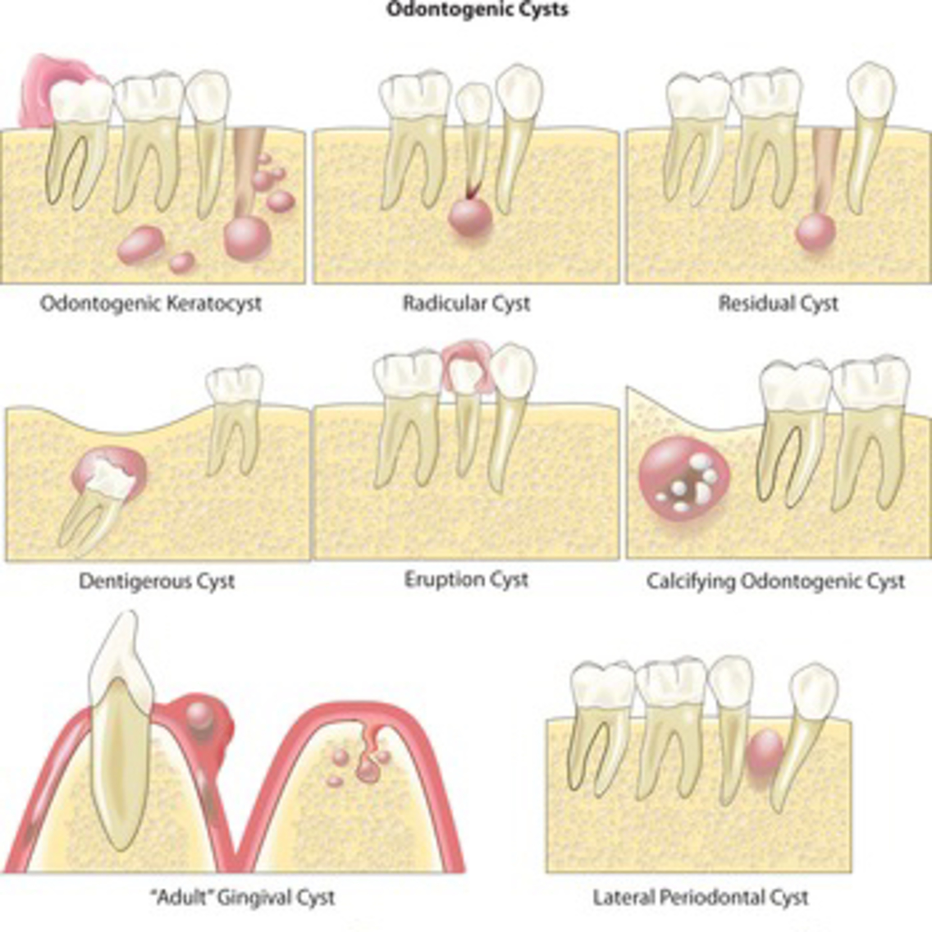 “What are the Cysts of the Jaws & Oral Cavity?” - Quick Read #45, 8.2.23 episode artwork
