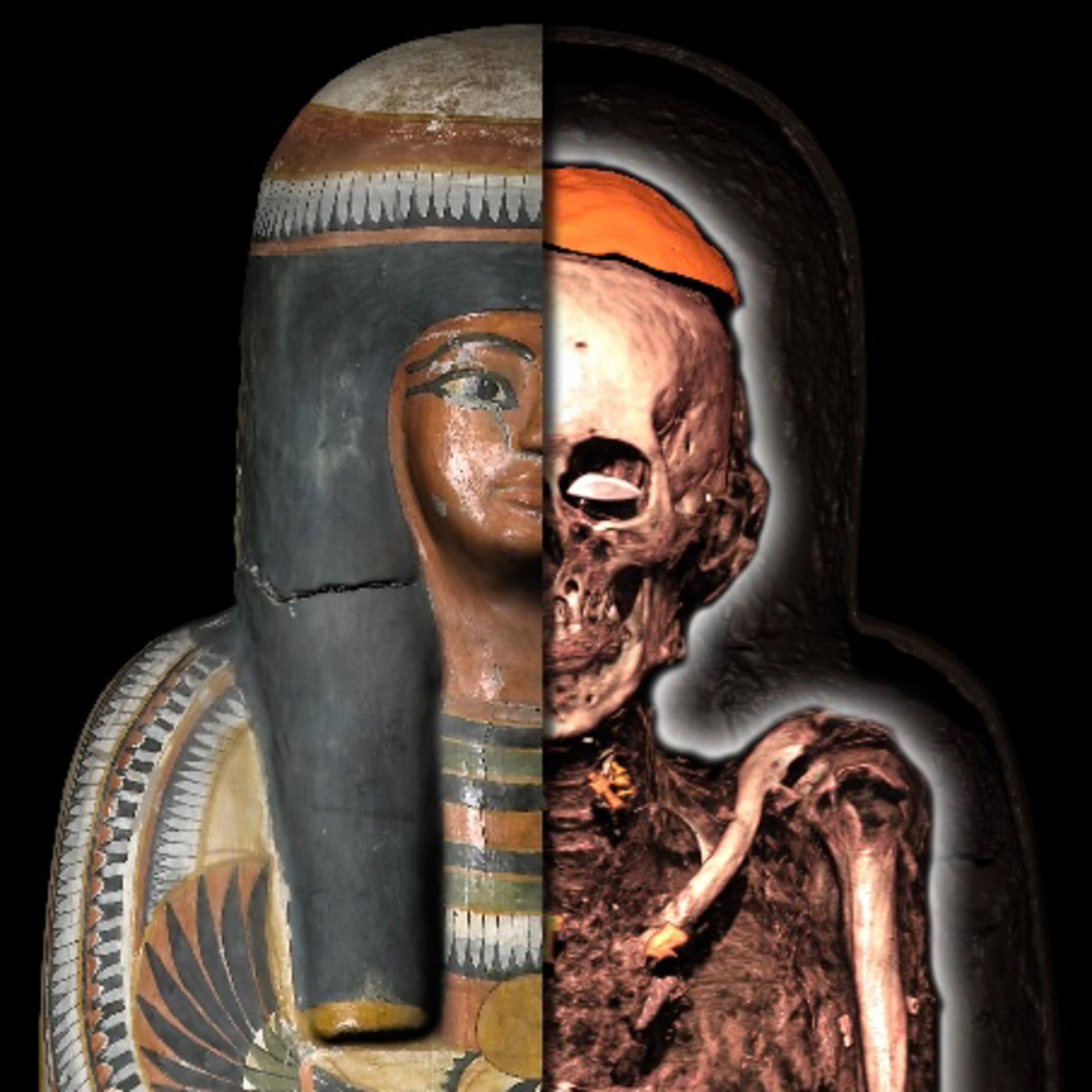 “What wasthe 3000 Year-Old Egyptian Mummy’s DentalProblem, and Whatwas Ancient Egyptian DentalCare?” episode artwork