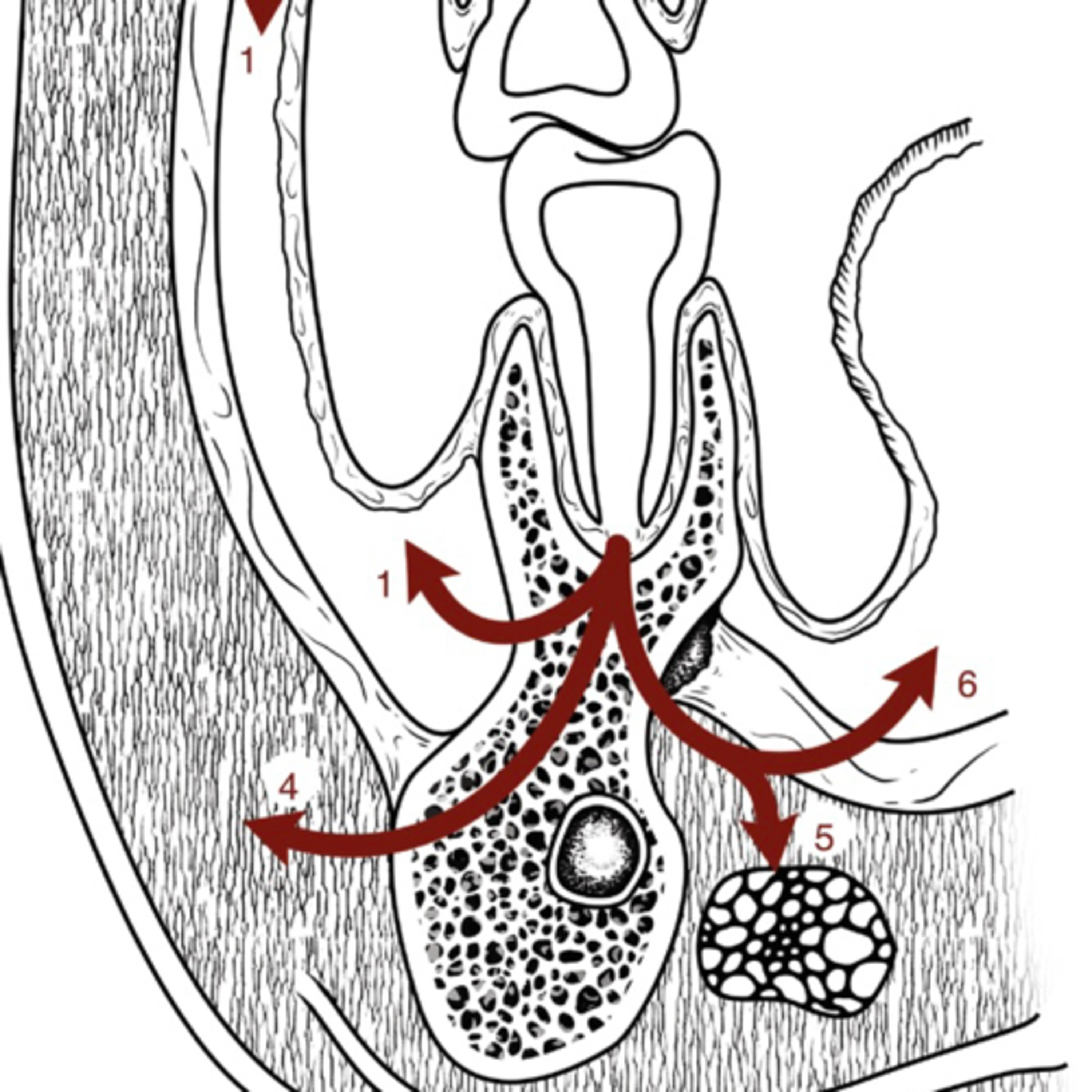 “Why is Leukocytosis Important When Evaluating Odontogenic Infections?” episode artwork