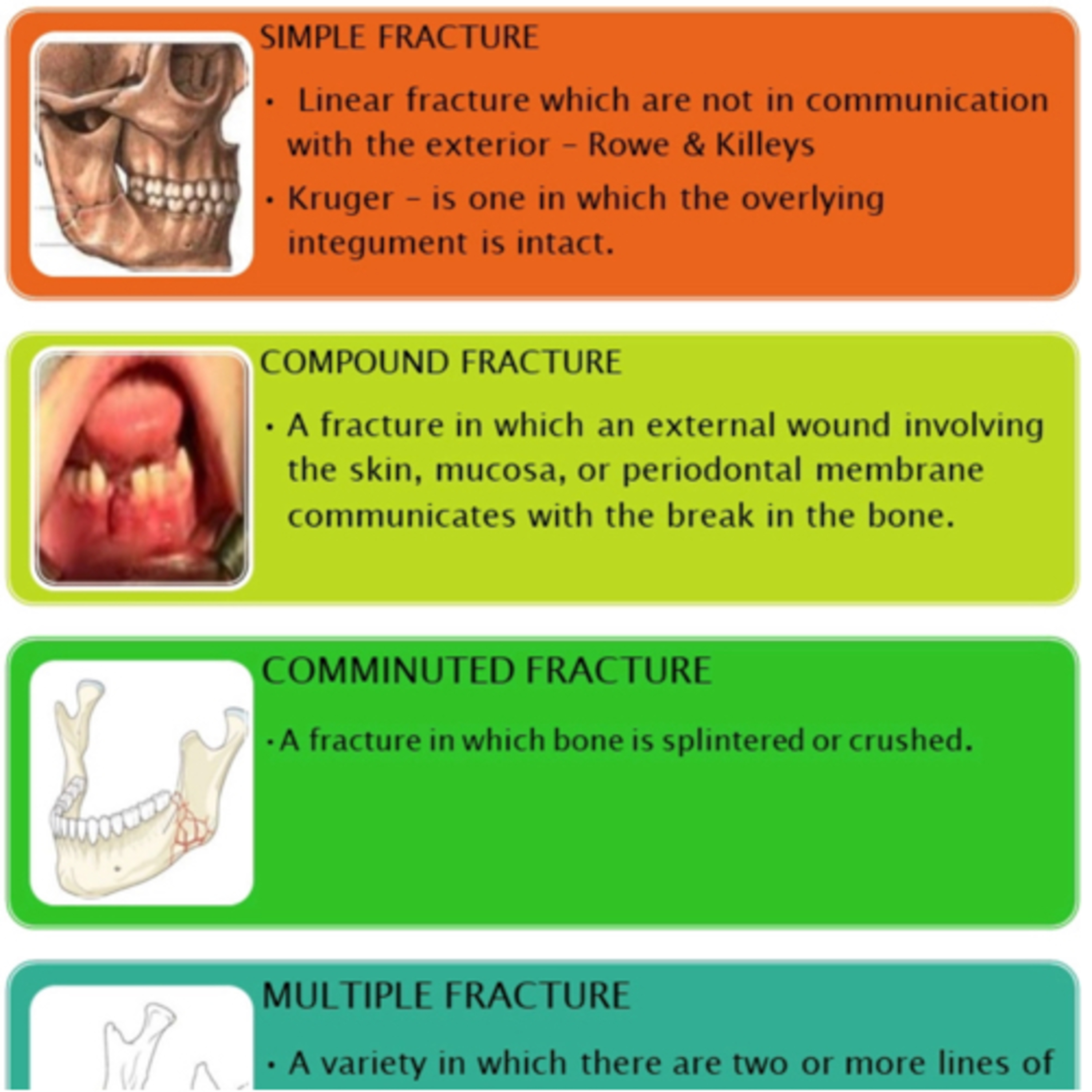 “What is a ‘Compound’ Fracture and How is it Treated Uniquely?” - Quick Read #71 (on LinkedIn, X) episode artwork