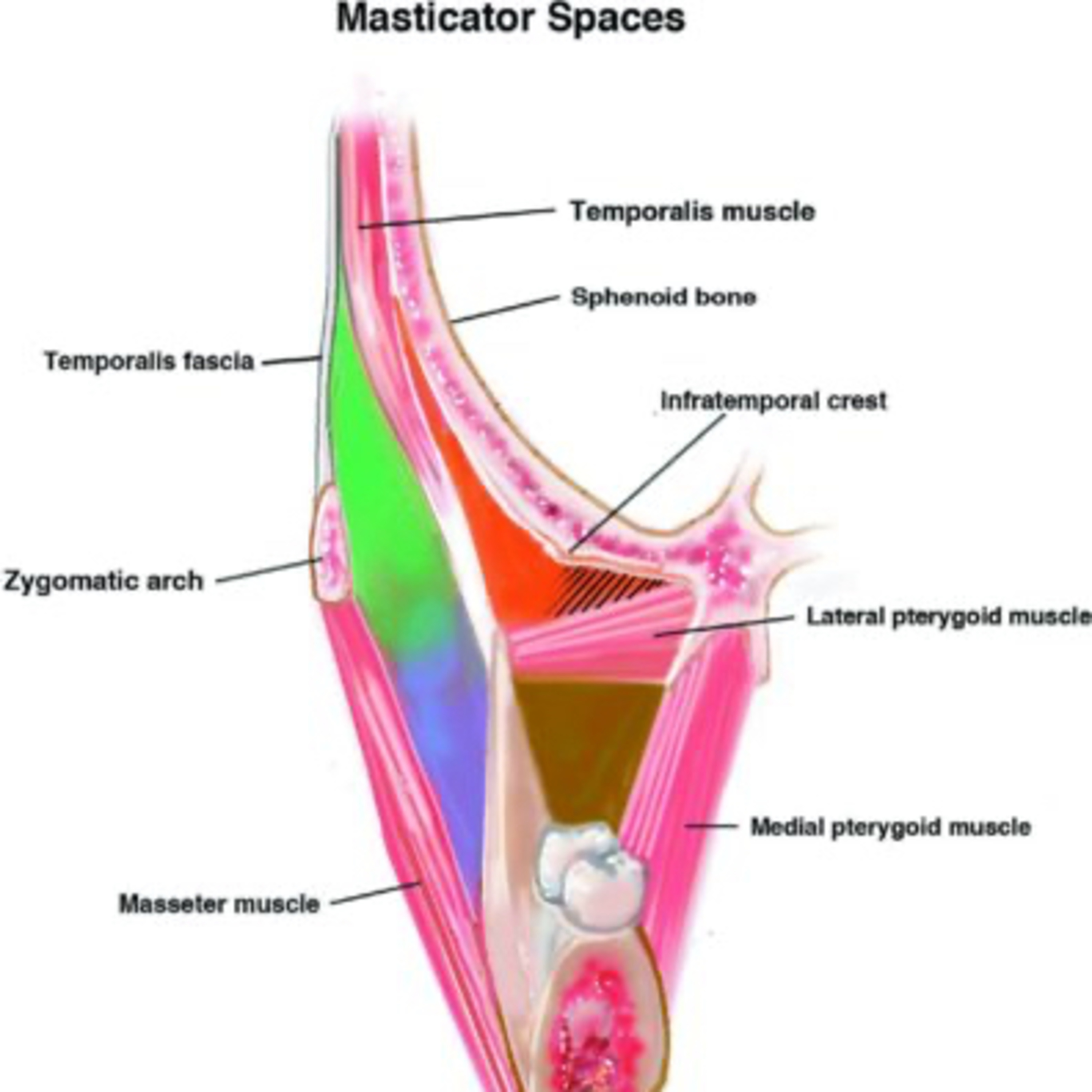“Which Spaces Can Be Involved in the Spread of Odontogenic Infection?” QR #73 + PODCAST EXCLUSIVE episode artwork