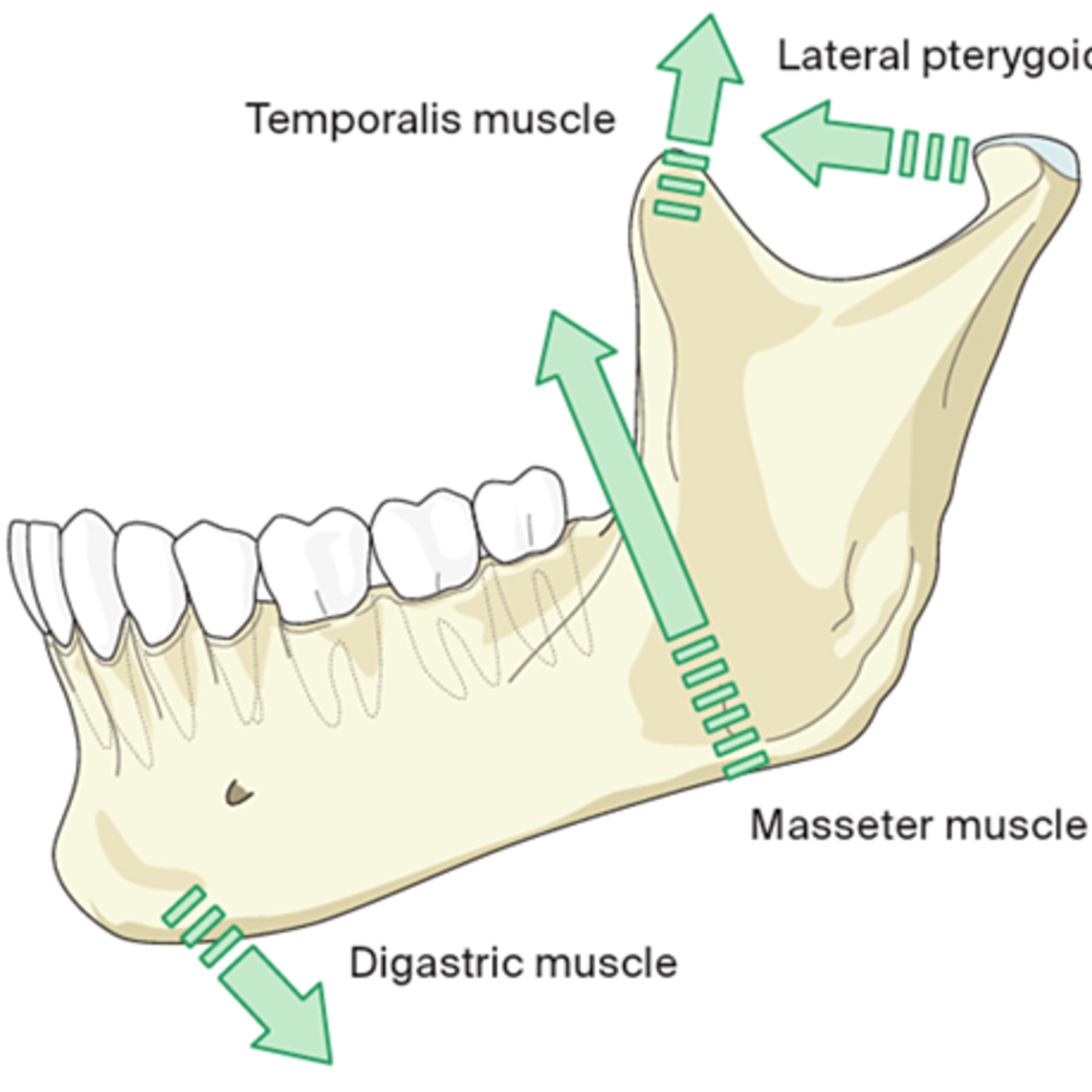 “What Muscle Pull Vectors Affect Displacement of Mandible Fractures?” episode artwork