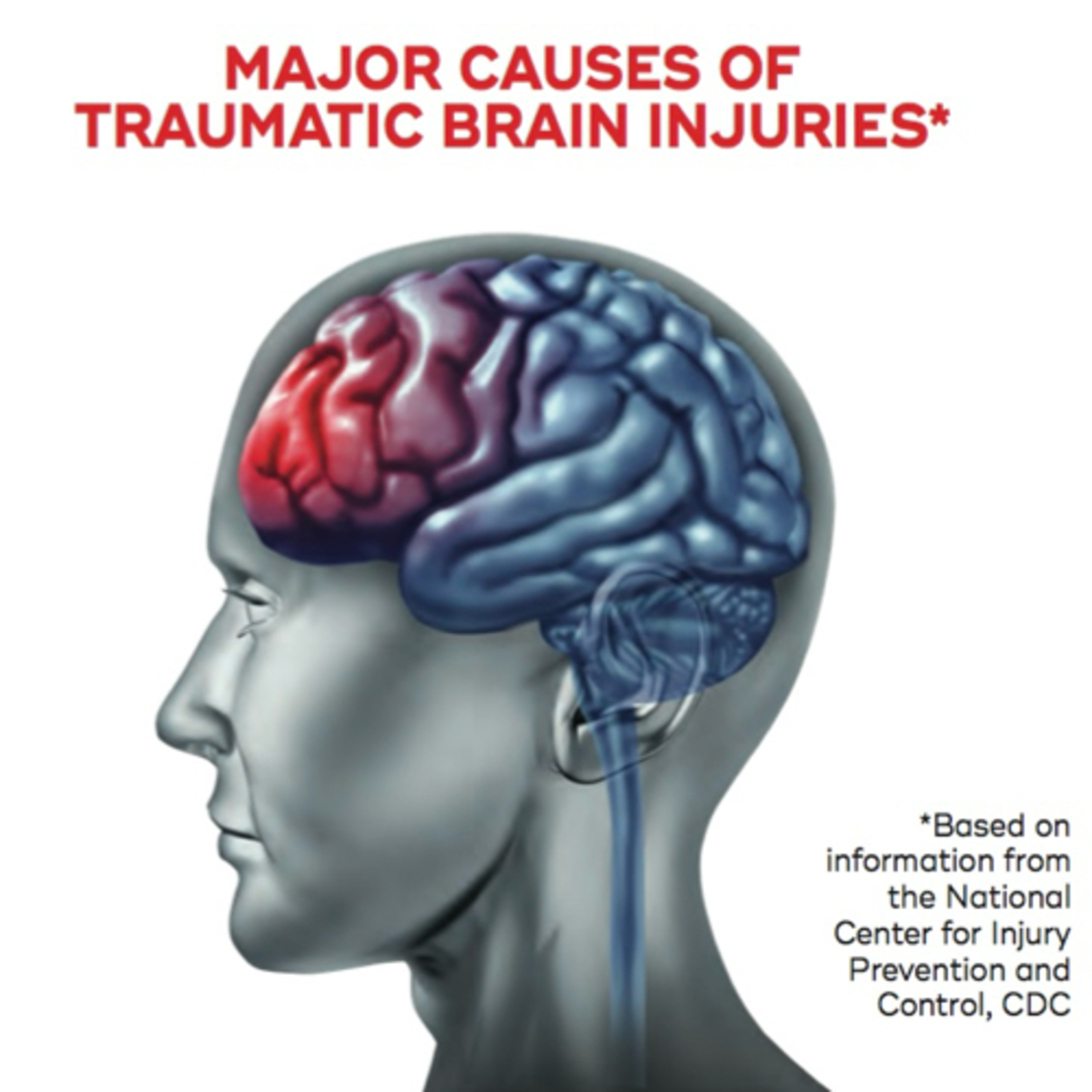 “What Signs & Symptoms on a Head & Neck Exam Might Indicate TBI (Traumatic Brain Injury)?” episode artwork
