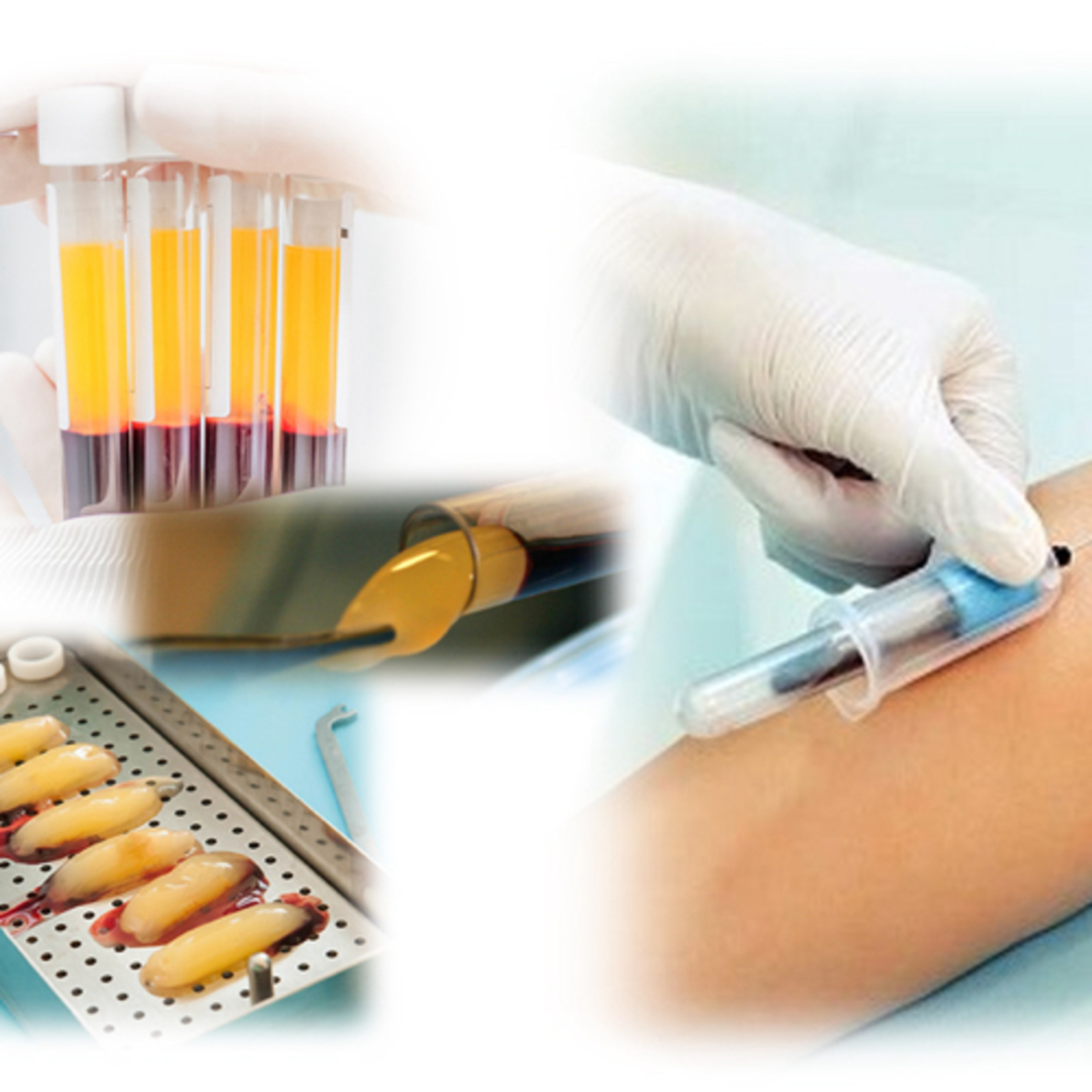 “How is PRF (Platelet-Rich Fibrin) Used in Dentistry?”  episode artwork
