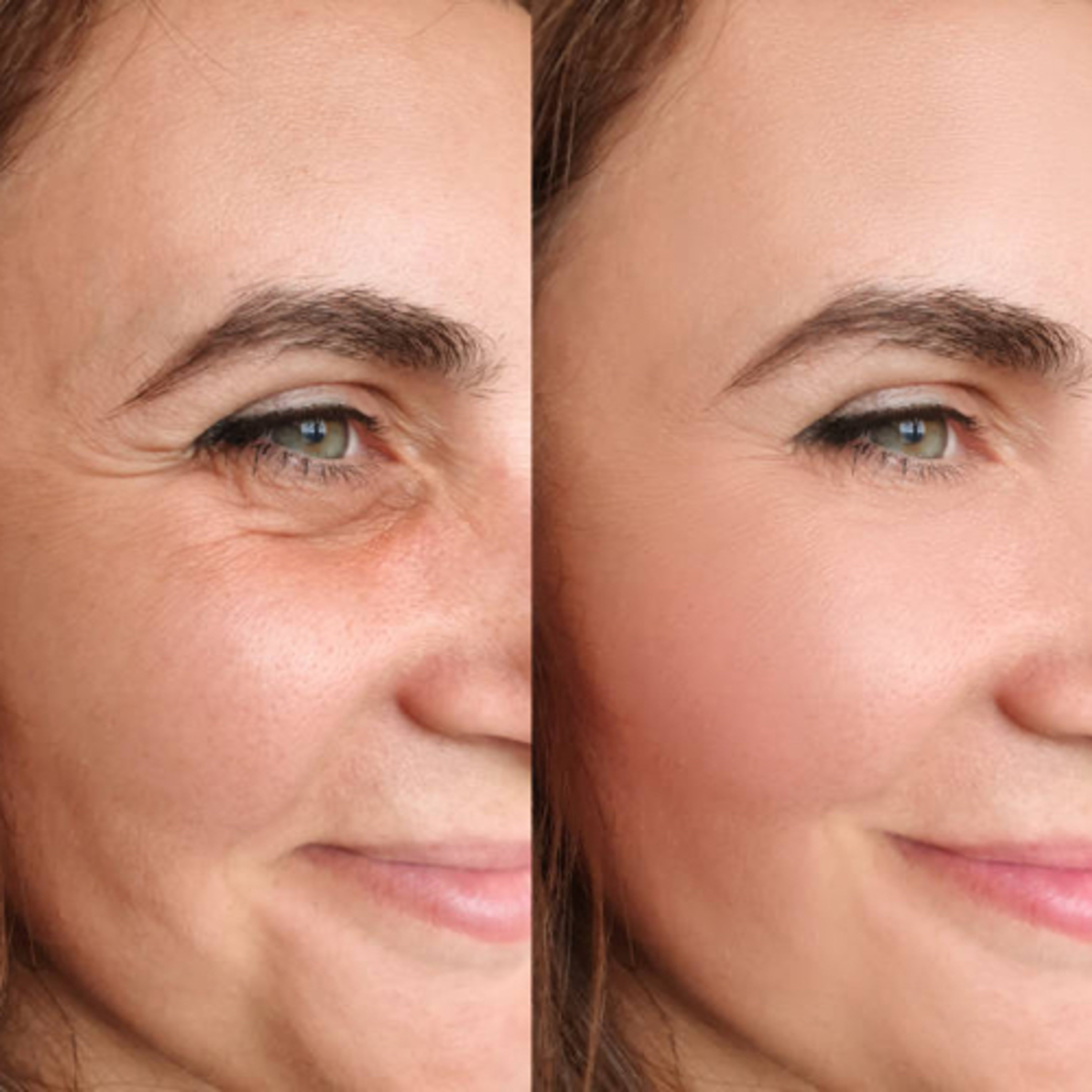 “How Does Botox Prevent Certain Effects of Aging?” episode artwork