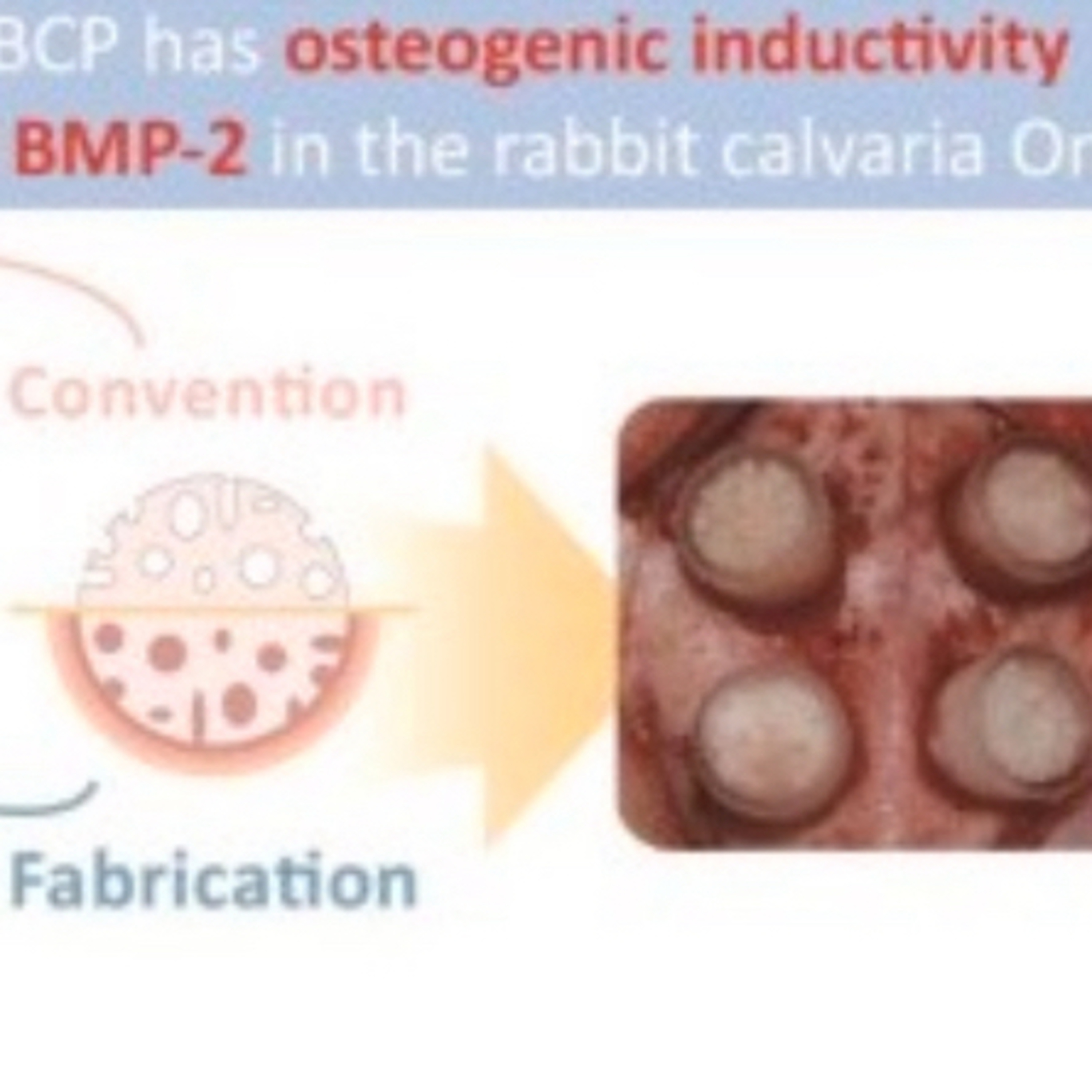 “Unlike Most BMP’s, How Does BMP-3 Cause Decreased Bone Formation?” episode artwork