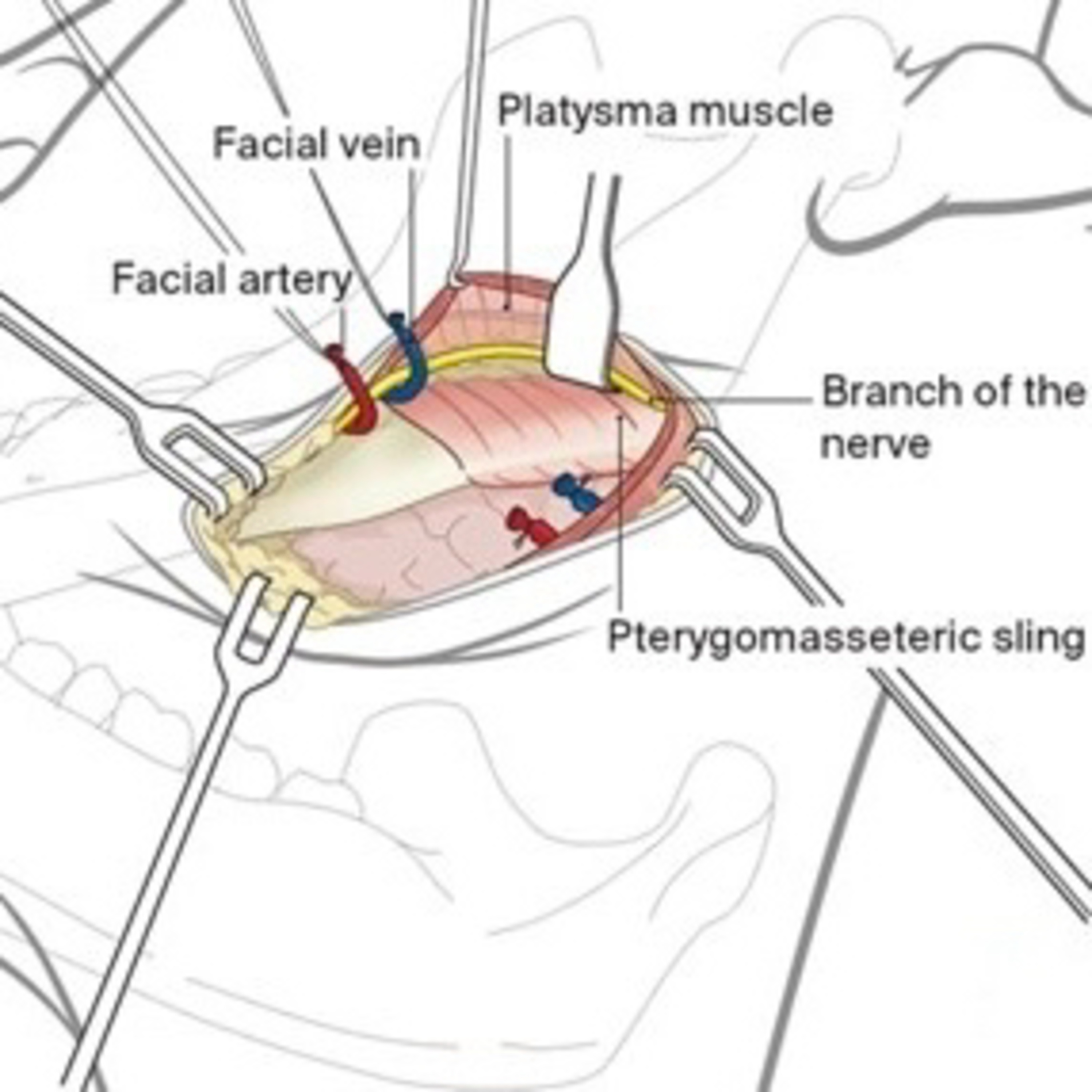 “What Are Key Considerations For The Submandibular Approach When Accessing The Mandible?”  episode artwork