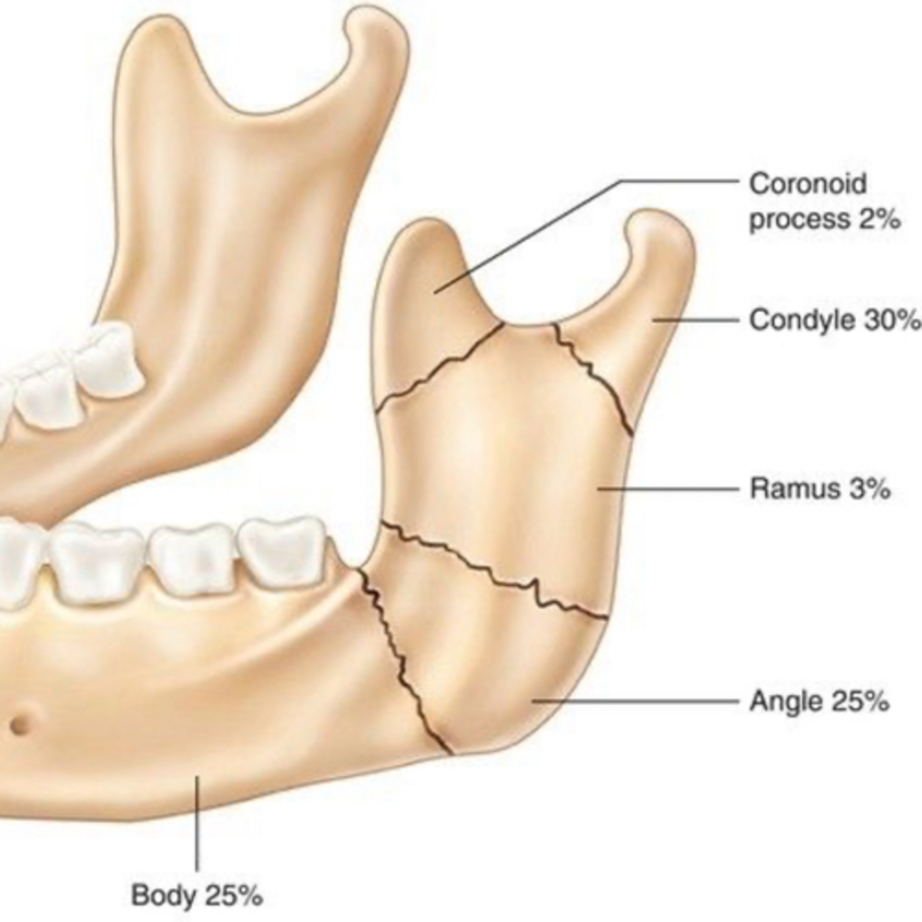 “How Do Types and Locations of Mandible Fractures Change With Age & Anatomy?” episode artwork
