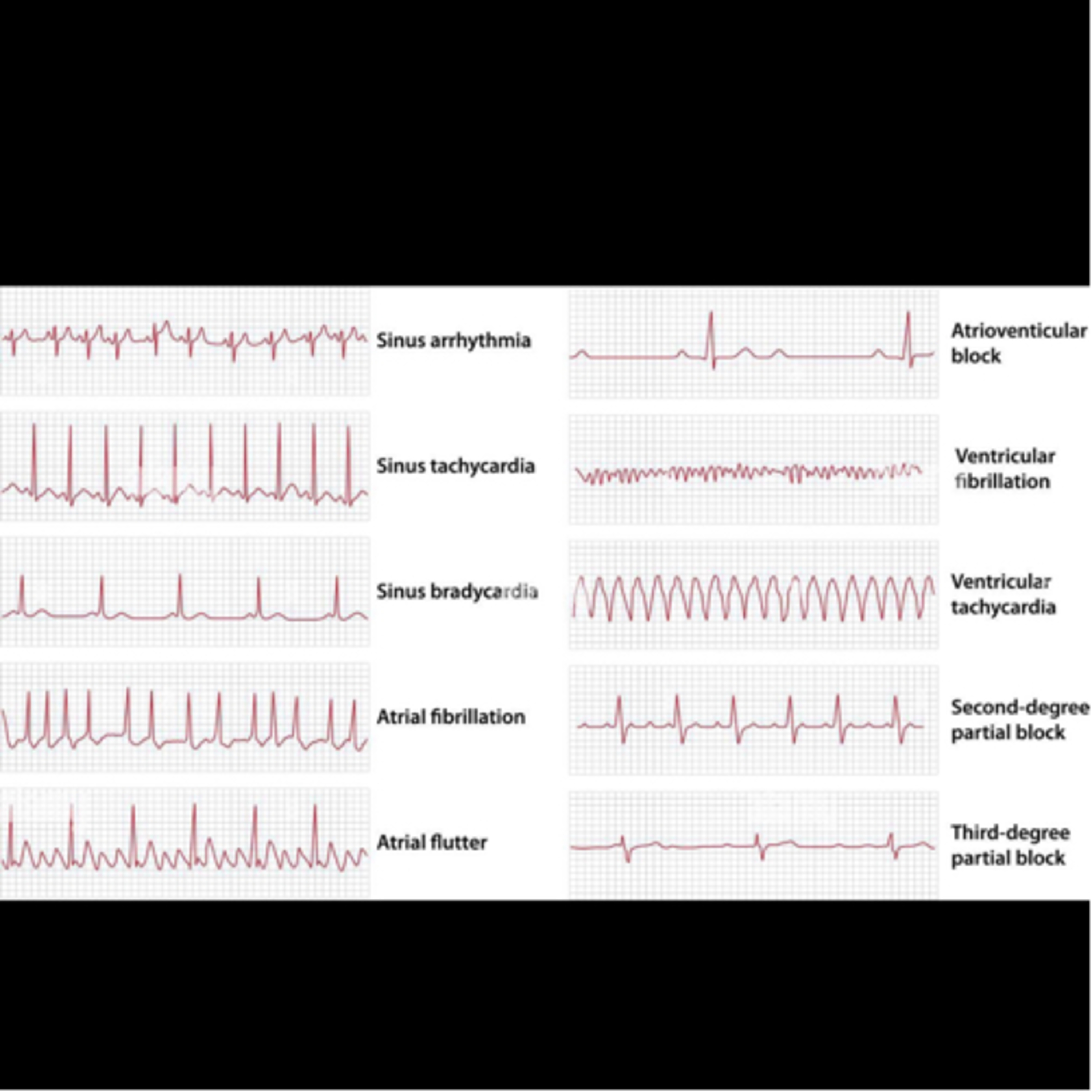 “What Are Common EKG Abnormalities To Look For?” episode artwork