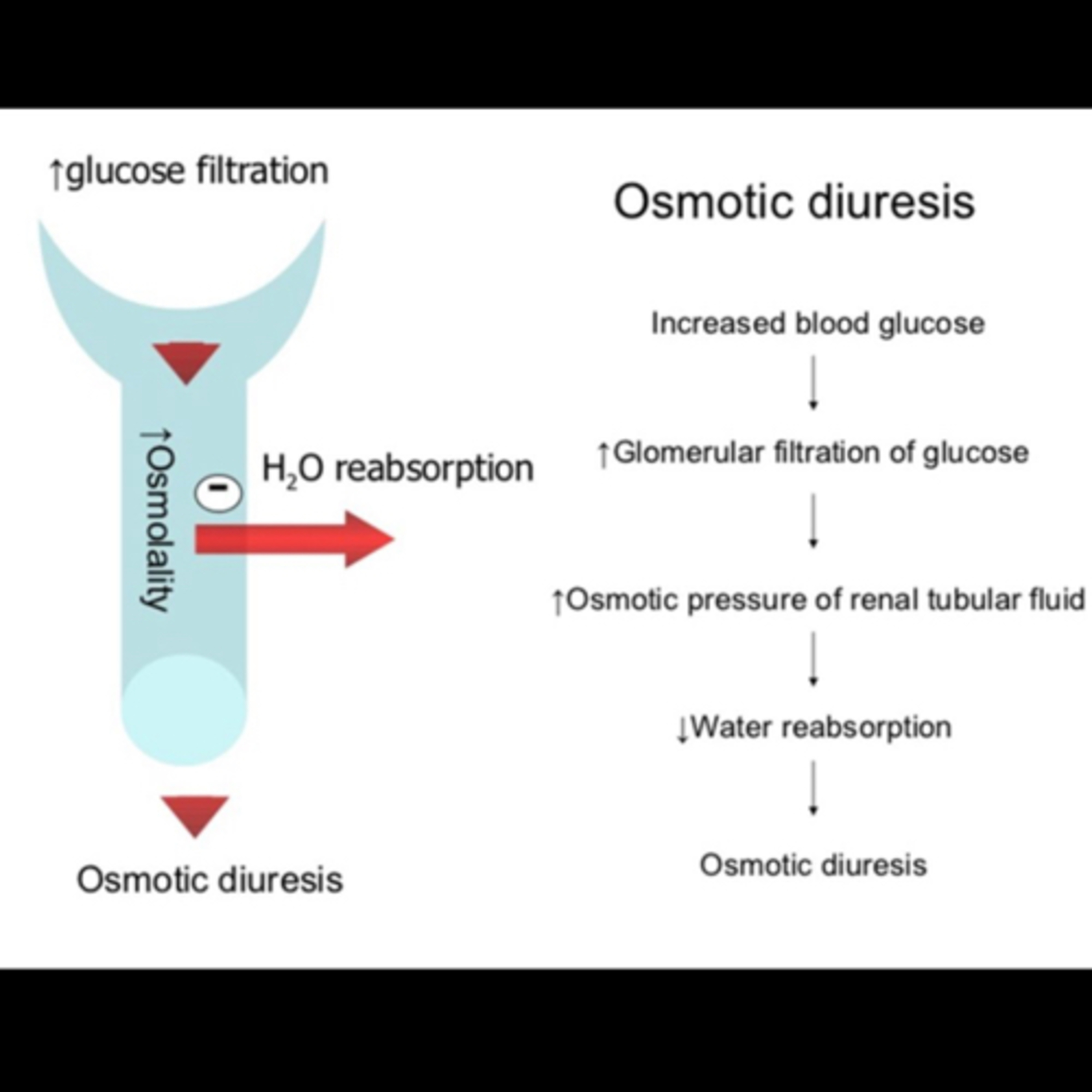 “What Is ‘Osmotic Diuresis’ In The Setting Of Diabetic Ketoacidosis?” episode artwork
