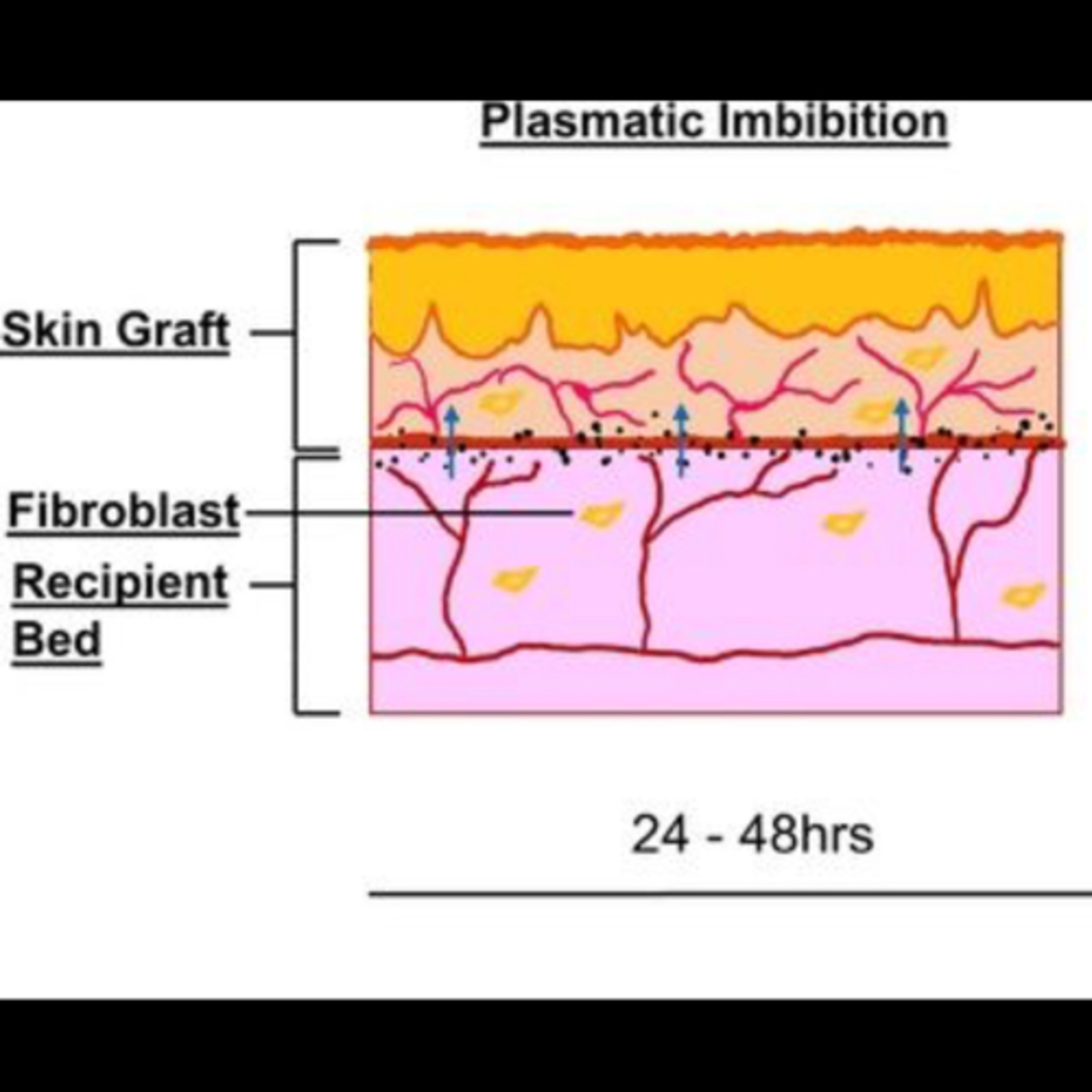“What is Plasmic Imbitition and its Role in Healing?” episode artwork
