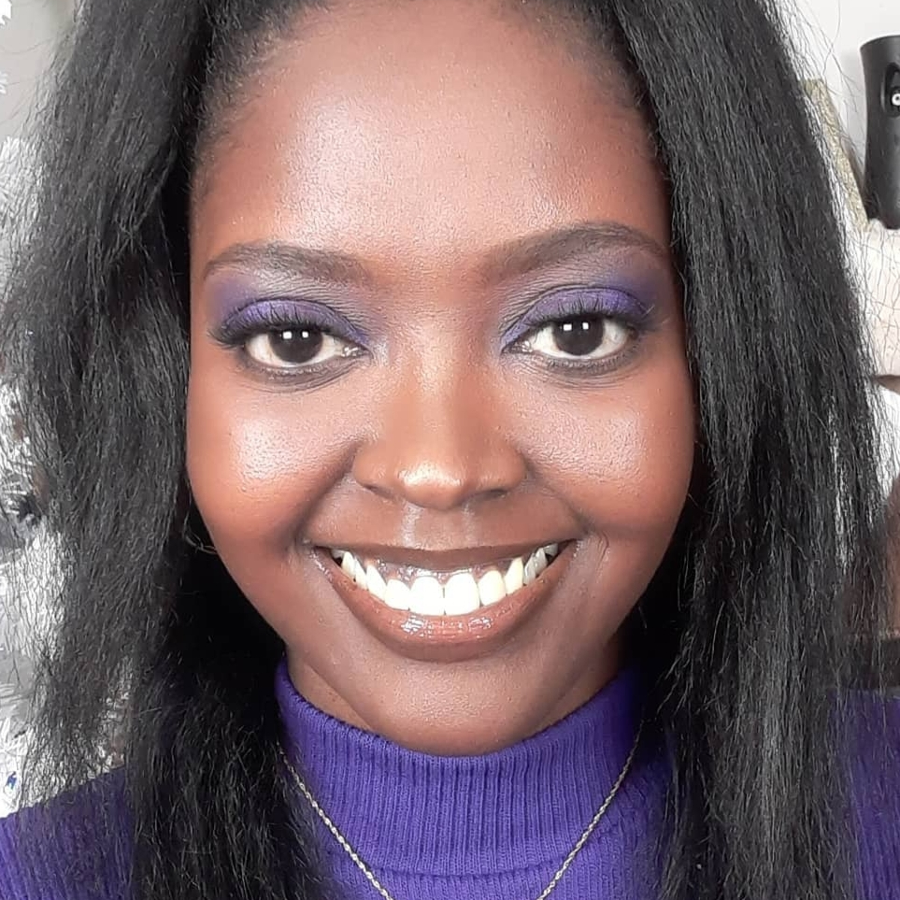 Susan Hendrix My Story Living With Lupus
