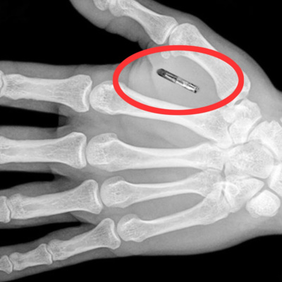 Microchipping Employees is a No-good, Horrible and Terrible Idea