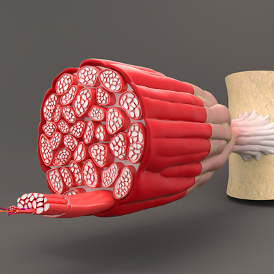 Rhabdomyolysis