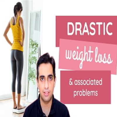 Drastic weight loss & associated problems