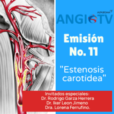 ANGIO TV
