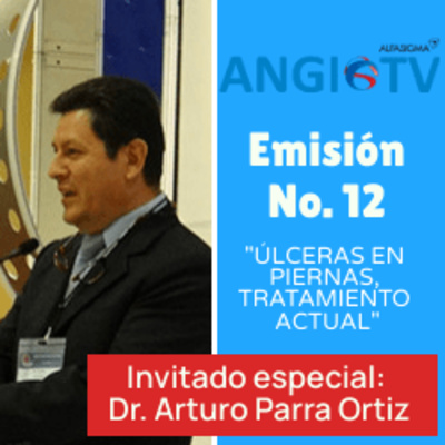 ANGIO TV
