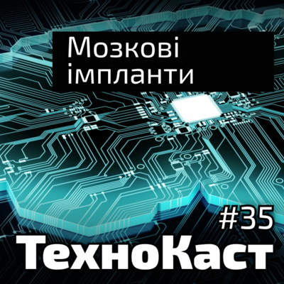 Мозкові імпланти, суд за чіти, CES-2022. Технокаст №35