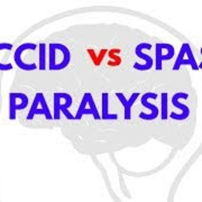 Flaccidity vs Spasticity: Where are these from? by For_Physiomentalists