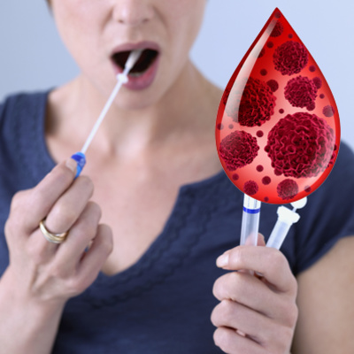 Saliva Diagnostics: Krebszellen innerhalb von 10 Minuten im Speichel erkennen?