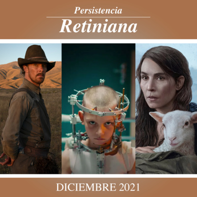 Persistencia Retiniana