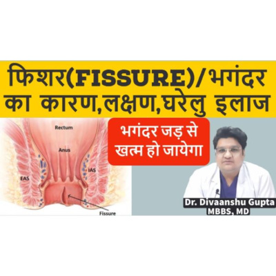 फिशर(भगंदर) के कारण लक्षण घरेलु इलाज बचाव ,Fissure symptoms and cure