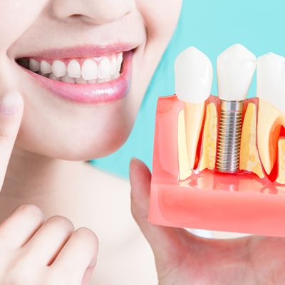 Causas y Efectos de la Pérdida de Órganos Dentarios